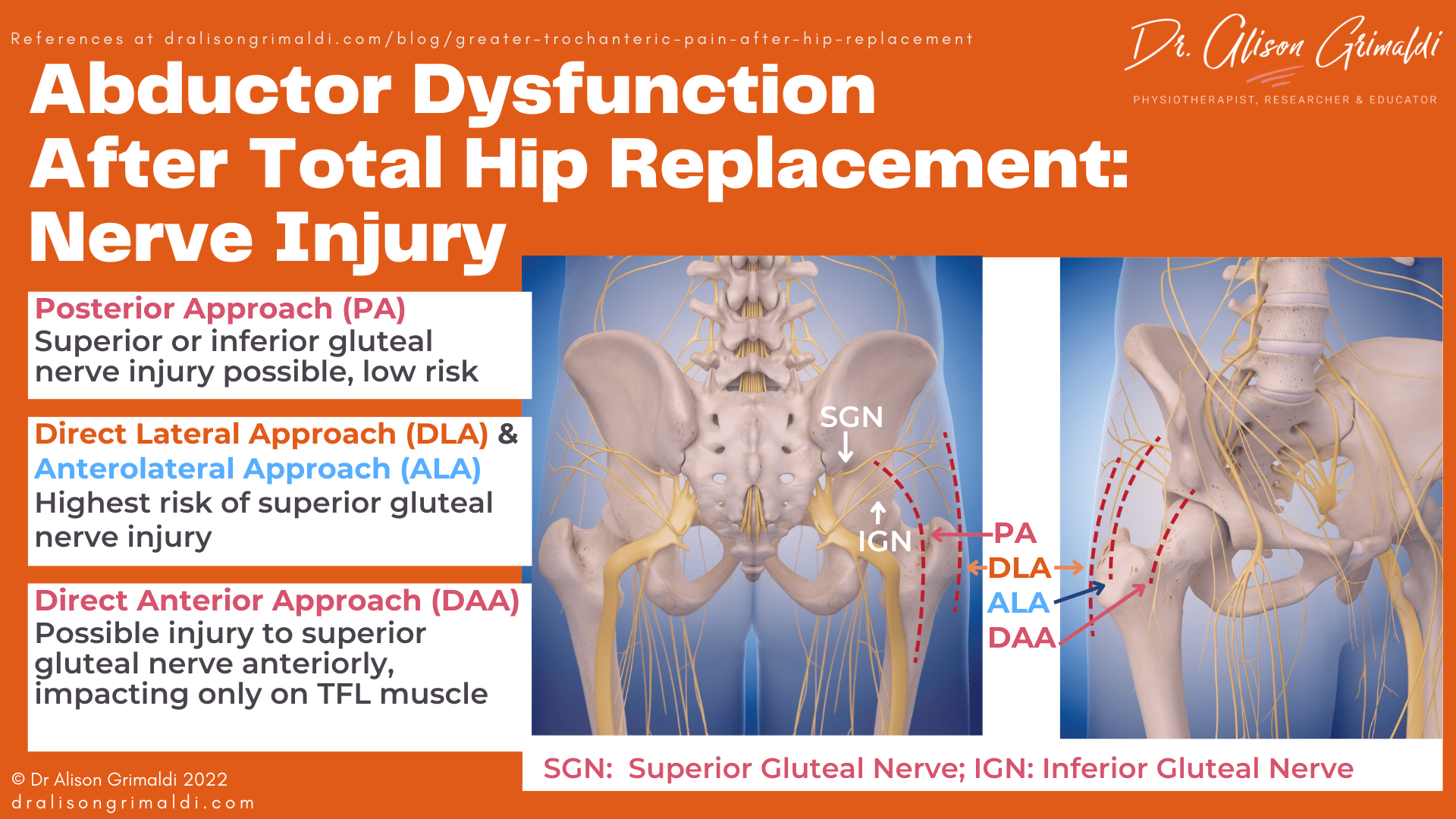 Abductor Dysfunction After Total Hip Replacement: Nerve Injury