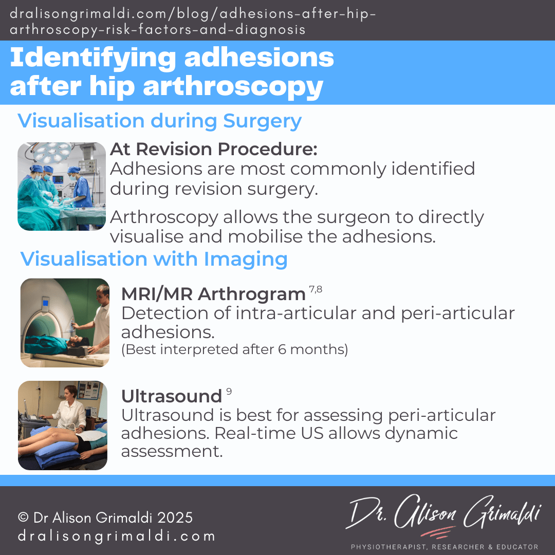 Identifying-adhesions-after-hip-arthroscopy