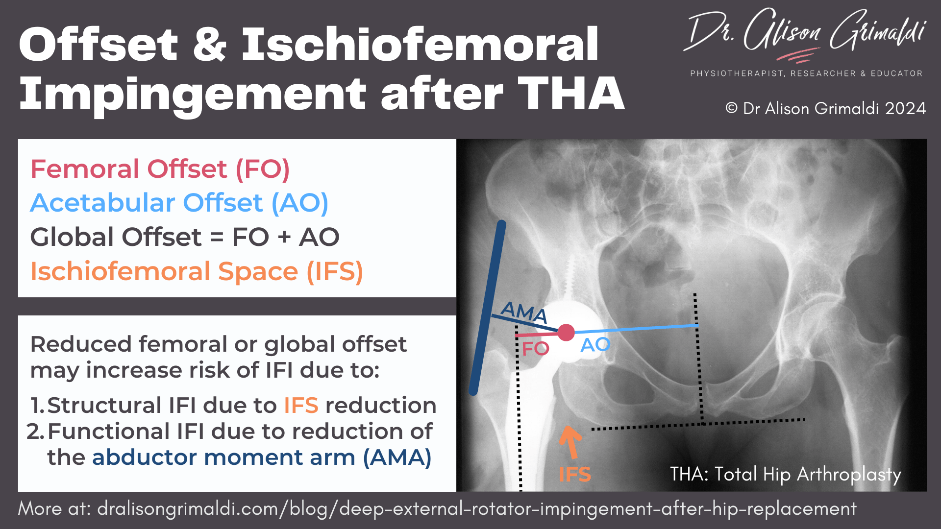 offset-&-ischiofemoral-impingement-after-THA