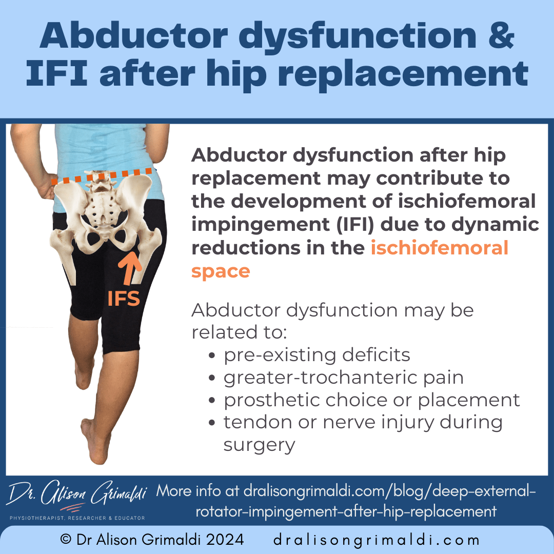 abductor-dysfunction-&-IFI-after-hip-replacement