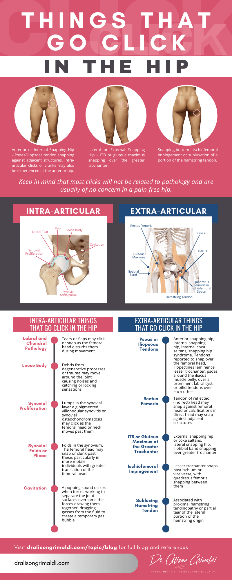 Dr Alison Grimaldi Infographic - Things that go click in the hip