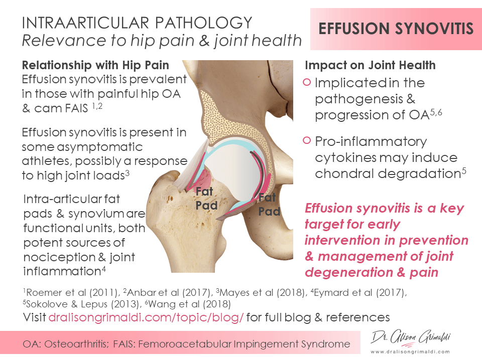 Infographic_Lig Teres Tear_dralisongrimaldi.com