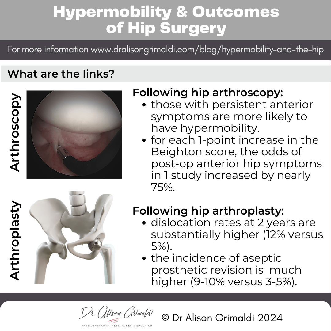 hypermobility-and-outcomes-of-hip-surgery