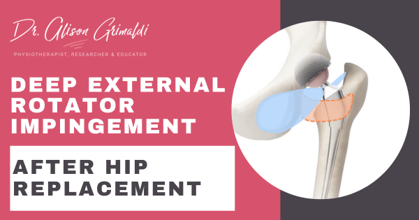 deep-external-rotator-impingement-after-hip-replacement