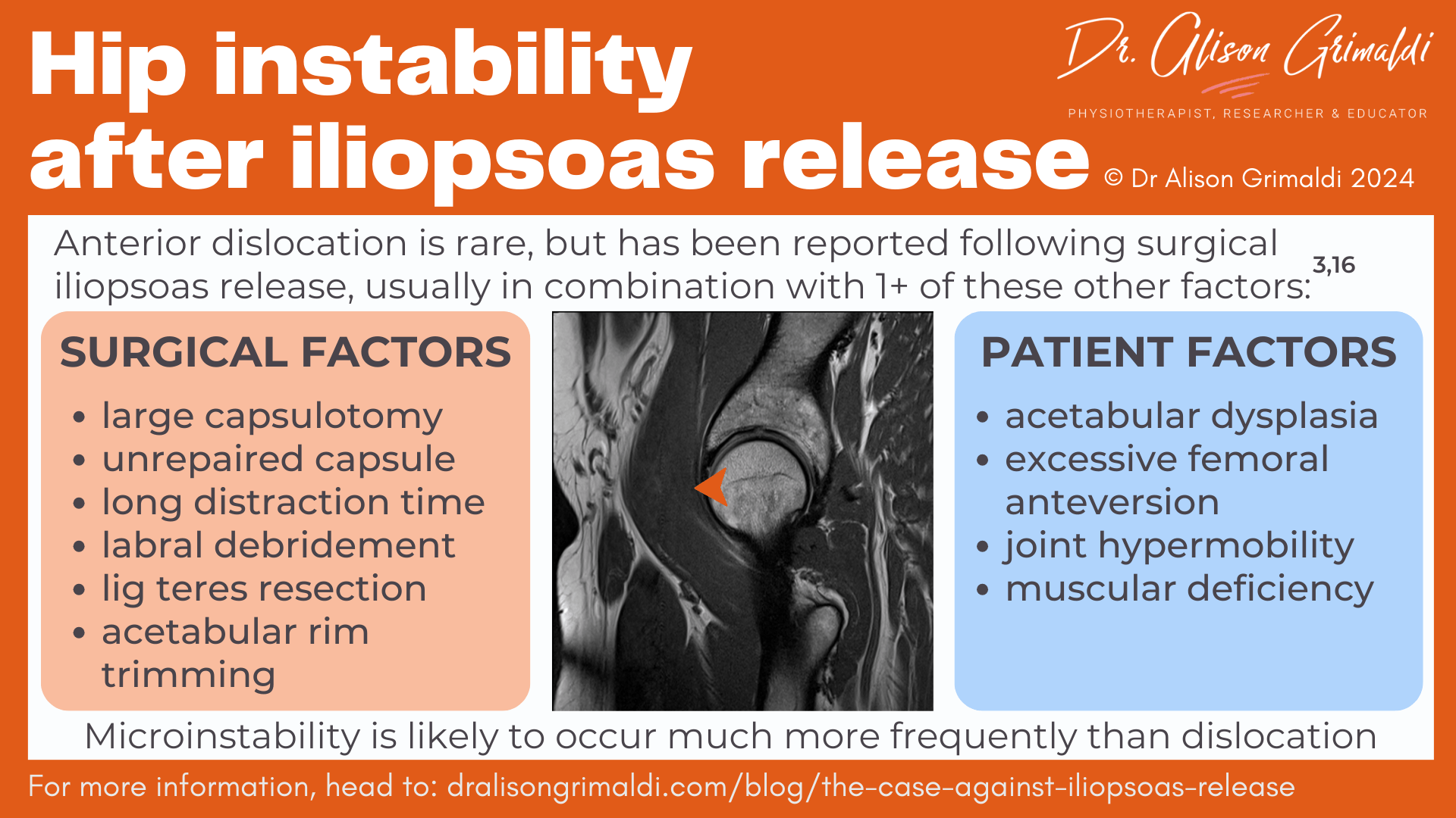 hip-instability-after-iliopsoas-release