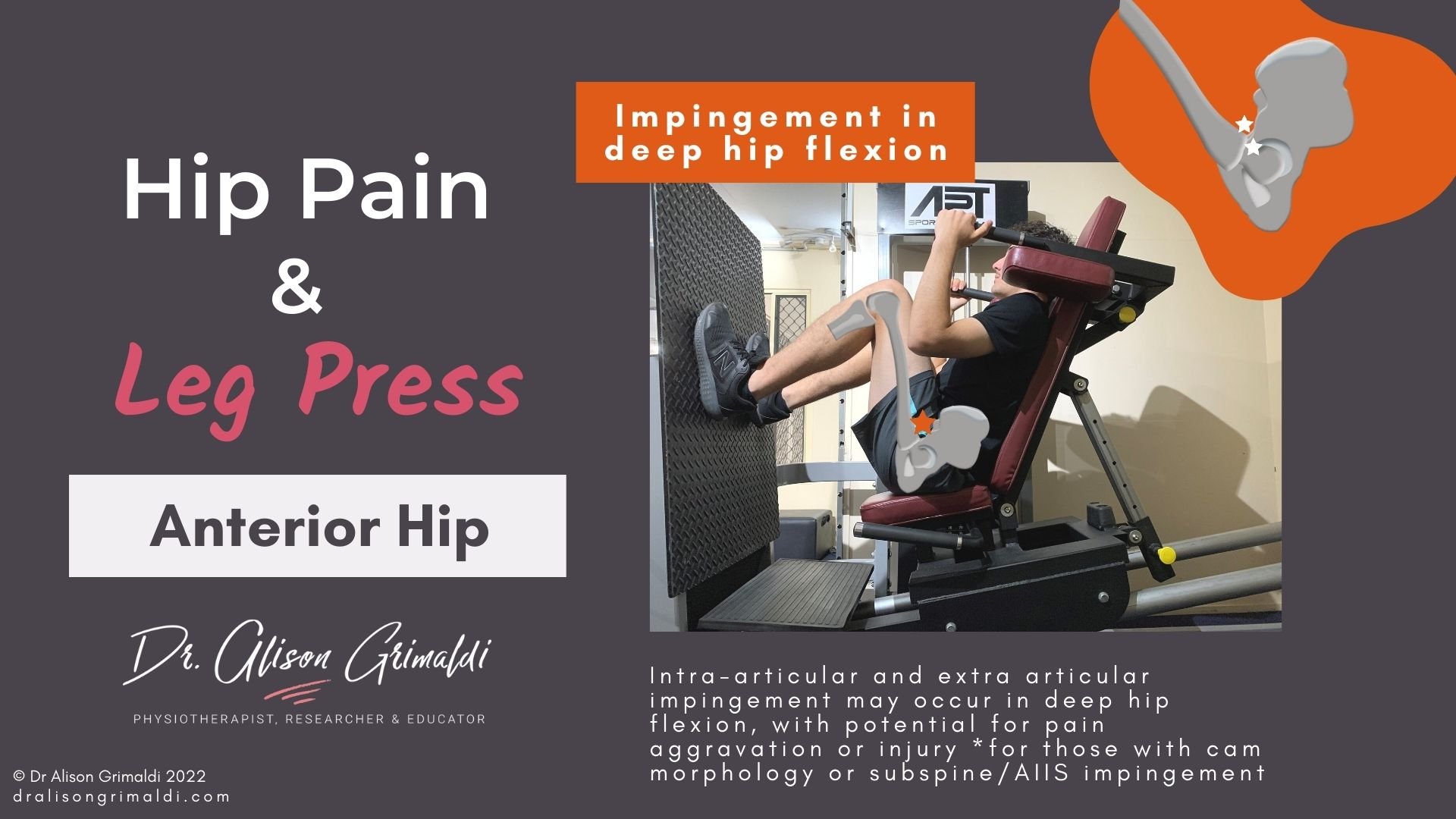 Anterior hip pain and leg press_low_dralisongrimaldi_blog Anterior hip pain and leg press - in the dralisongrimaldi_blog