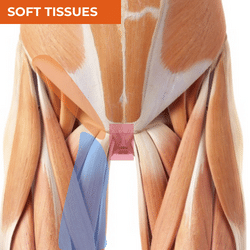 Differential Diagnosis of Groin Pain_Soft Tissues Differential Diagnosis of Groin Pain_Soft Tissues