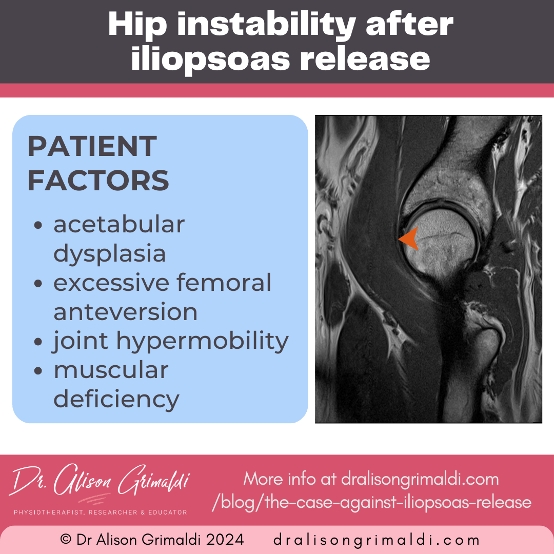 patient-factors-of-hip-instability-after-iliopsoas-release patient-factors-of-hip-instability-after-iliopsoas-release