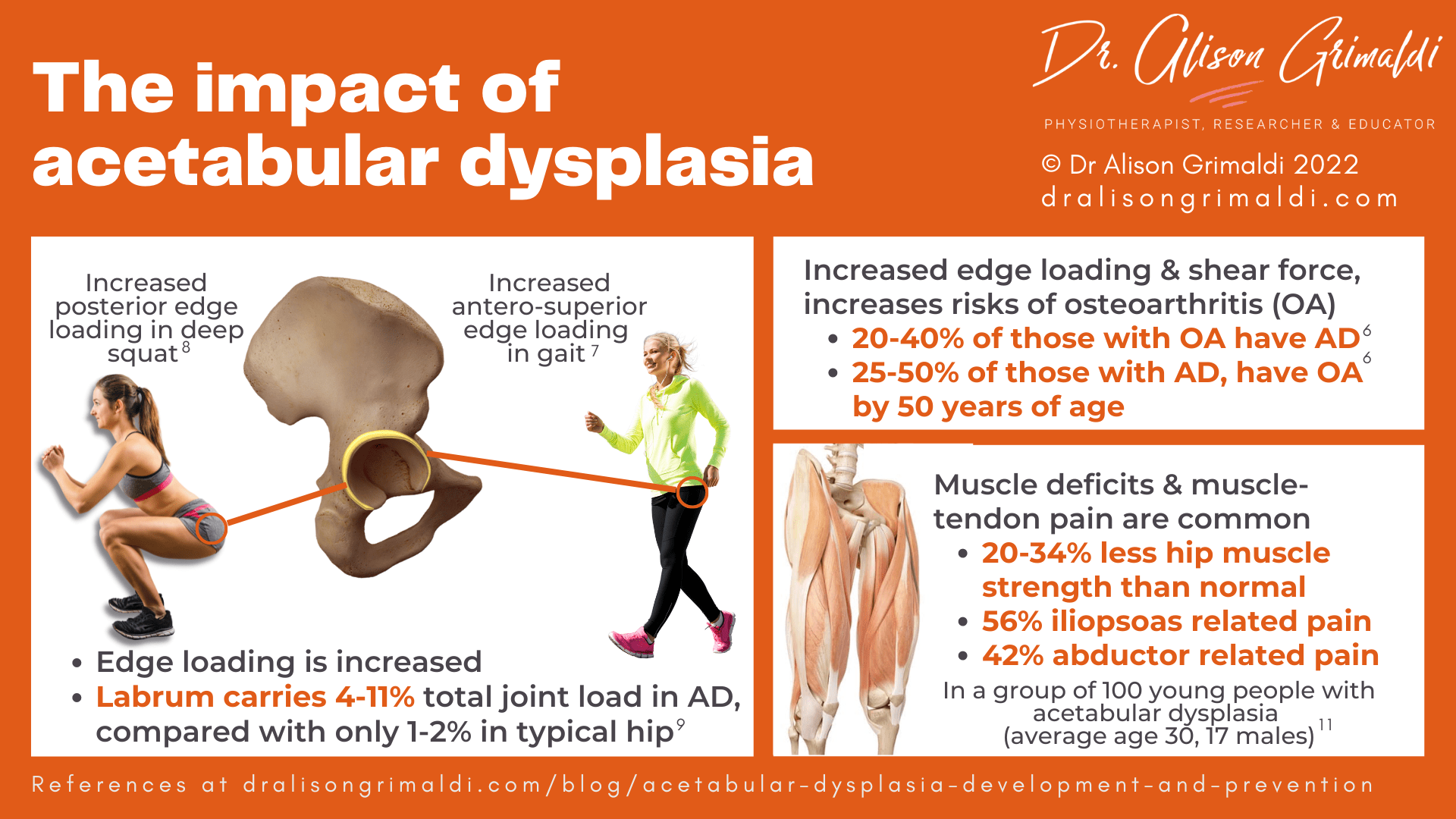 The impact of acetabular dysplasia The impact of acetabular dysplasia
