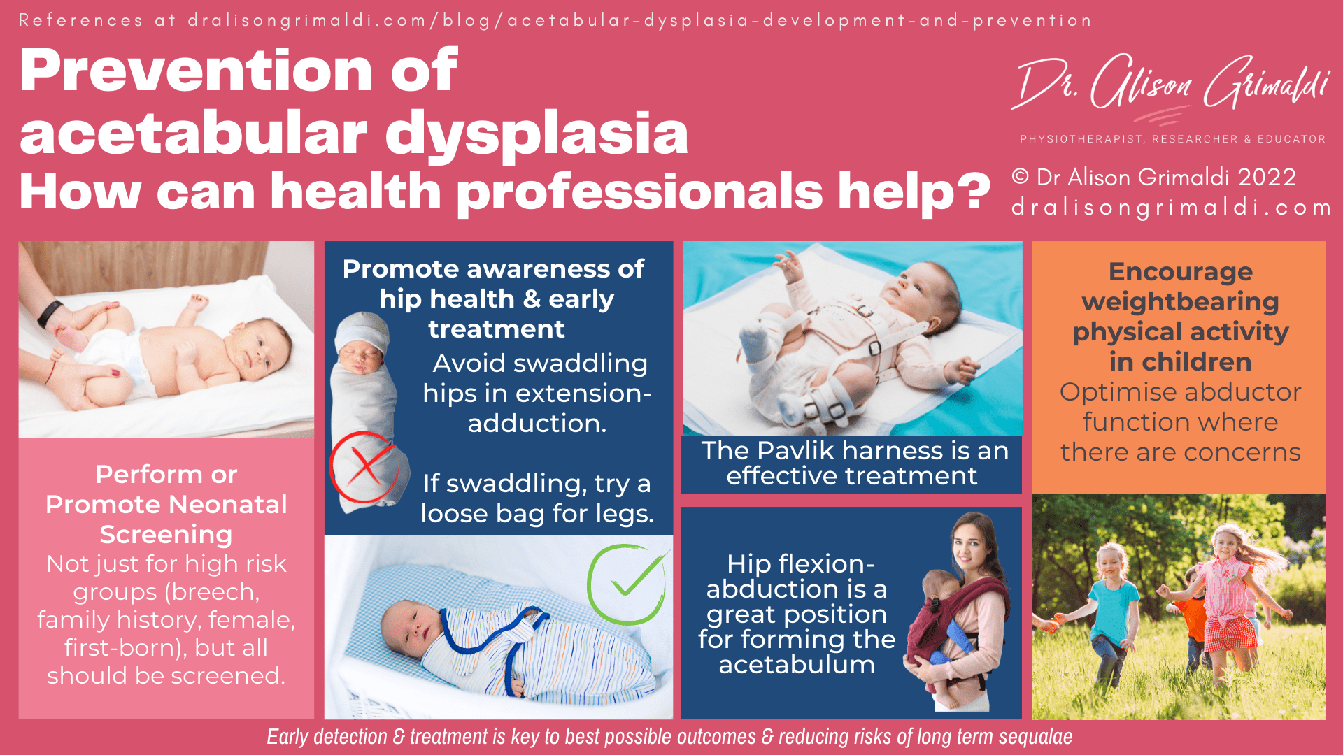 The relationship between physical activity, femoral neck-shaft angle & dysplasia The relationship between physical activity, femoral neck-shaft angle & dysplasia