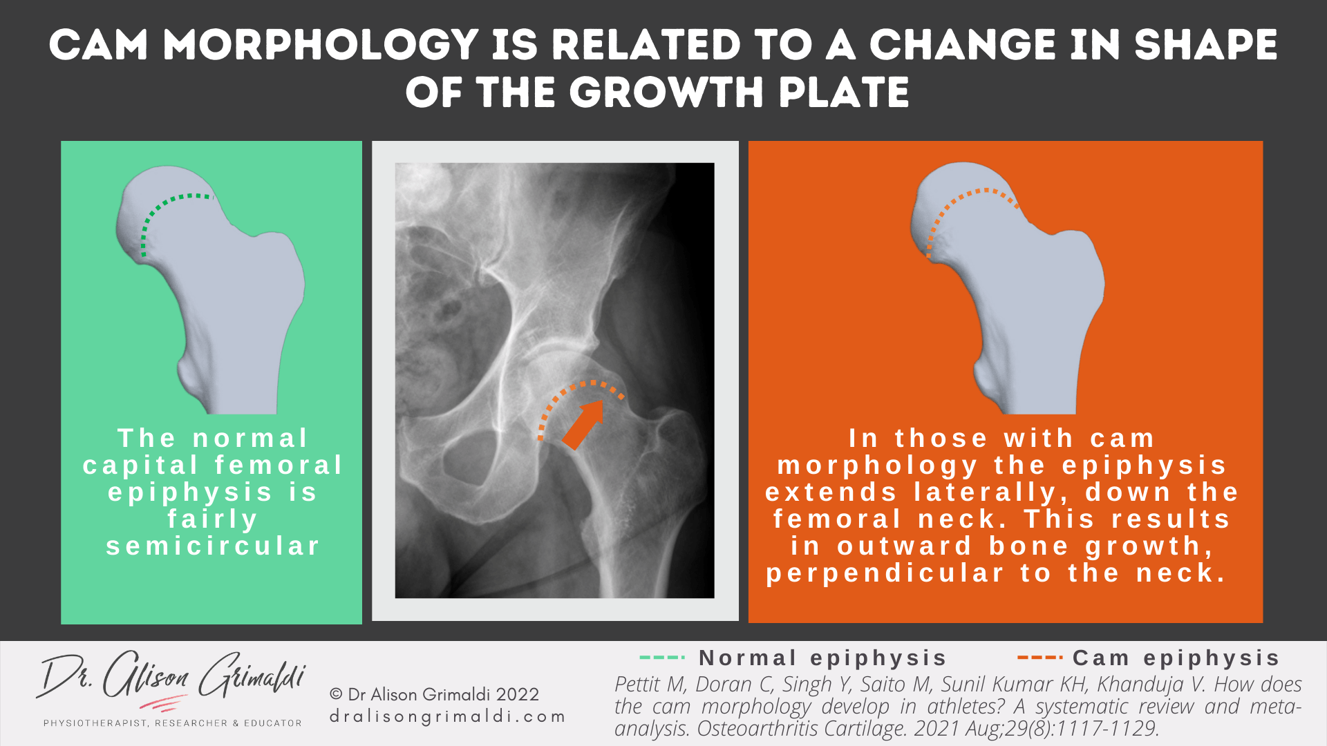 CHANGE IN GROWTH PLATE SHAPE CHANGE IN GROWTH PLATE SHAPE