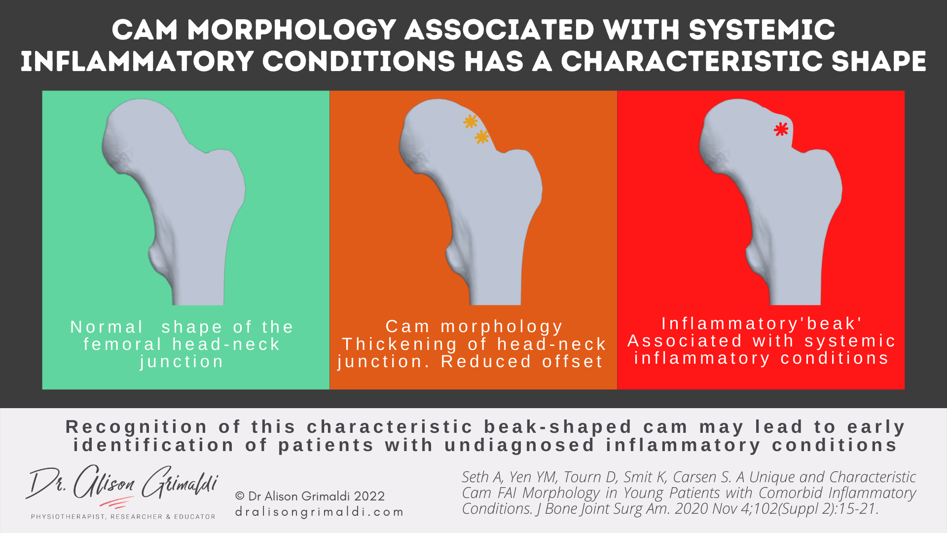 Pistol Grip vs inflammatory beak Pistol Grip vs inflammatory beak