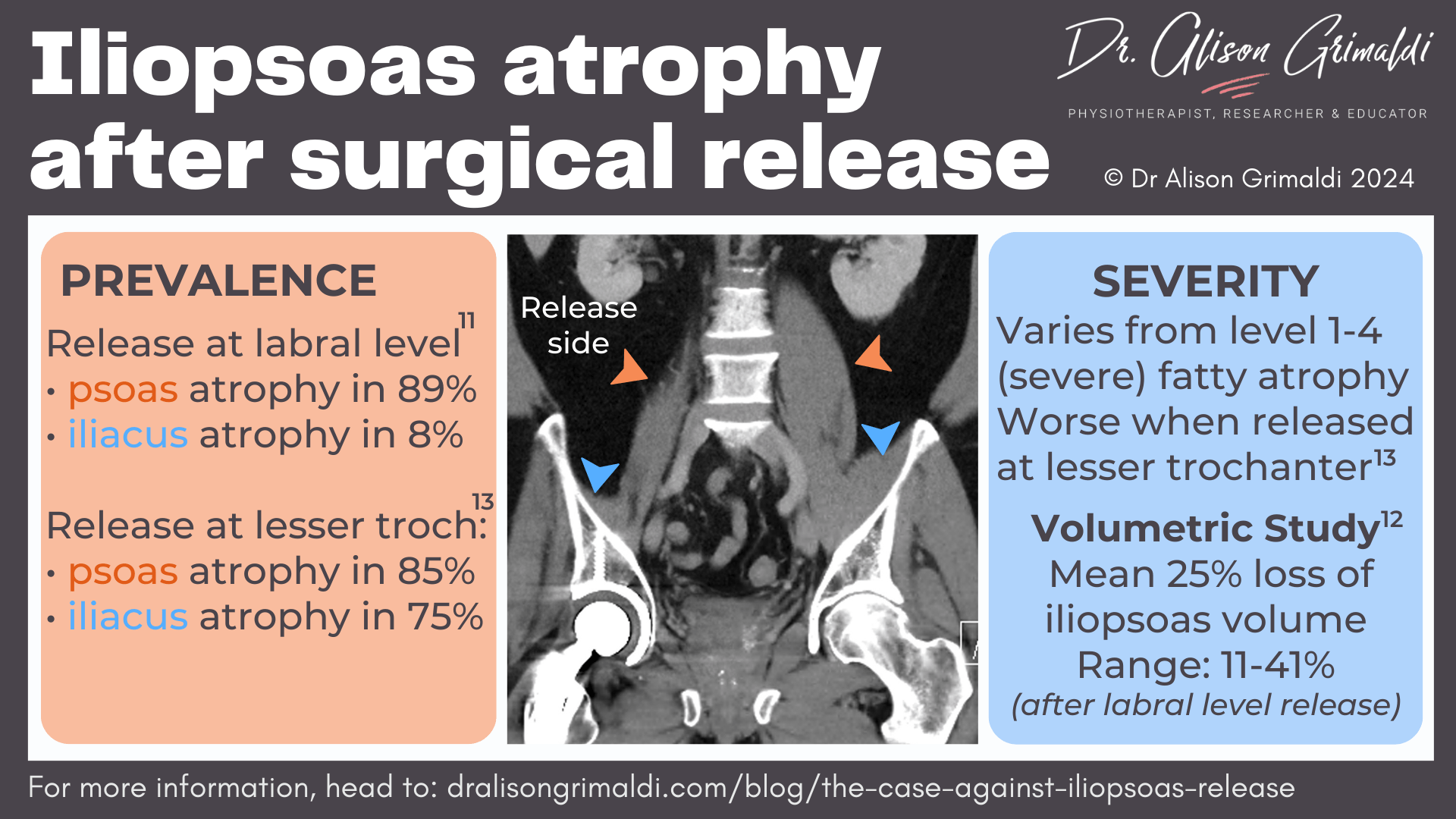 iliopsoas-atrophy-after-surgical-release iliopsoas-atrophy-after-surgical-release