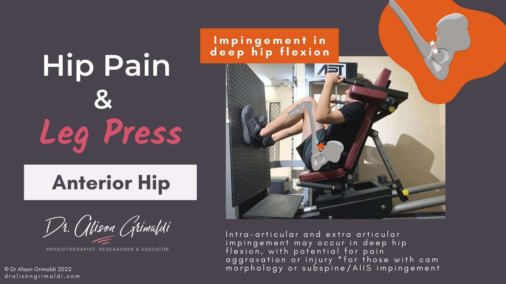 Anterior hip pain and leg press - in the dralisongrimaldi_blog