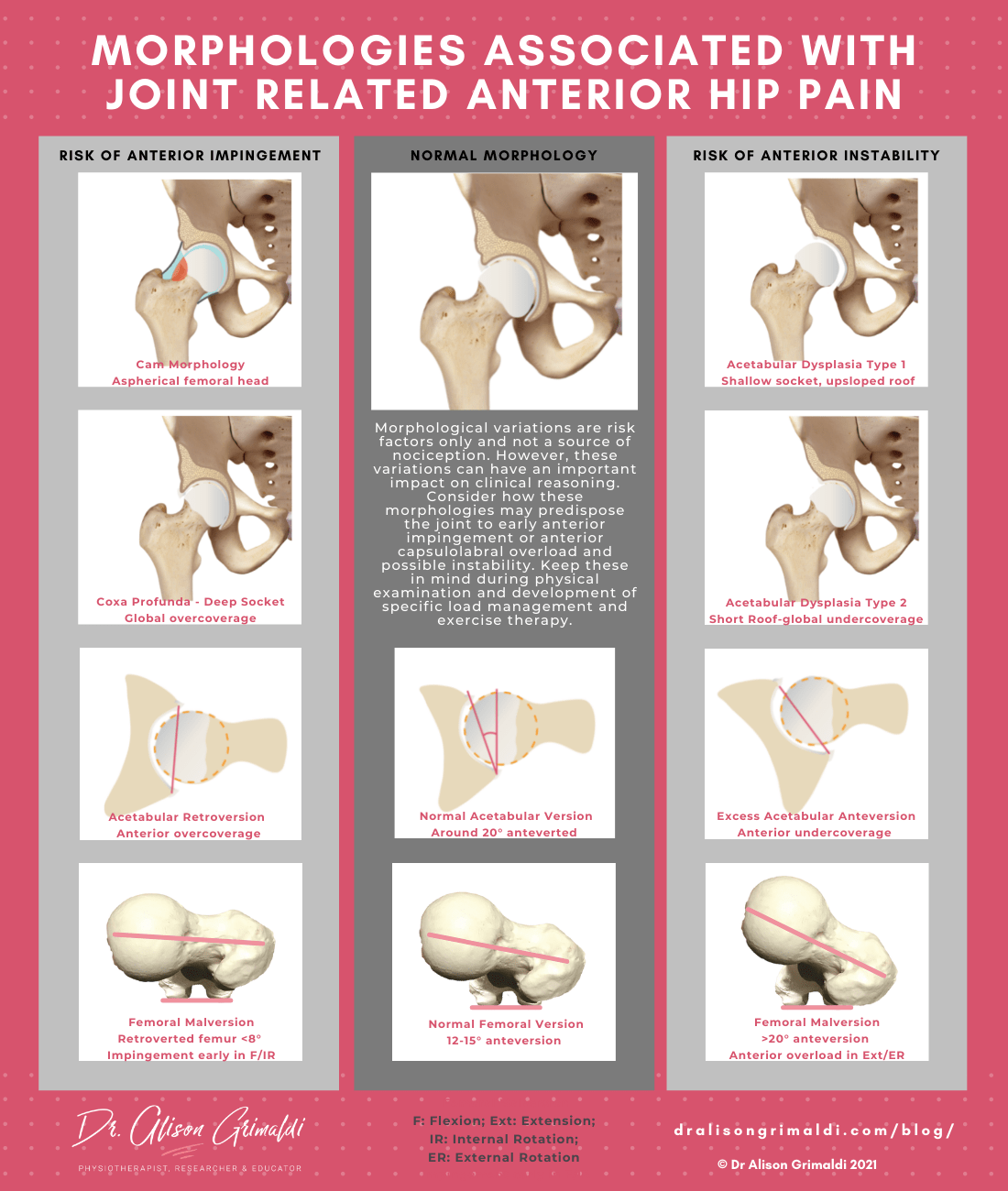 Dr Alison Grimaldi Blog Infographic_Morphology and joint related anterior hip pain Dr Alison Grimaldi Blog Infographic_Morphology and joint related anterior hip pain