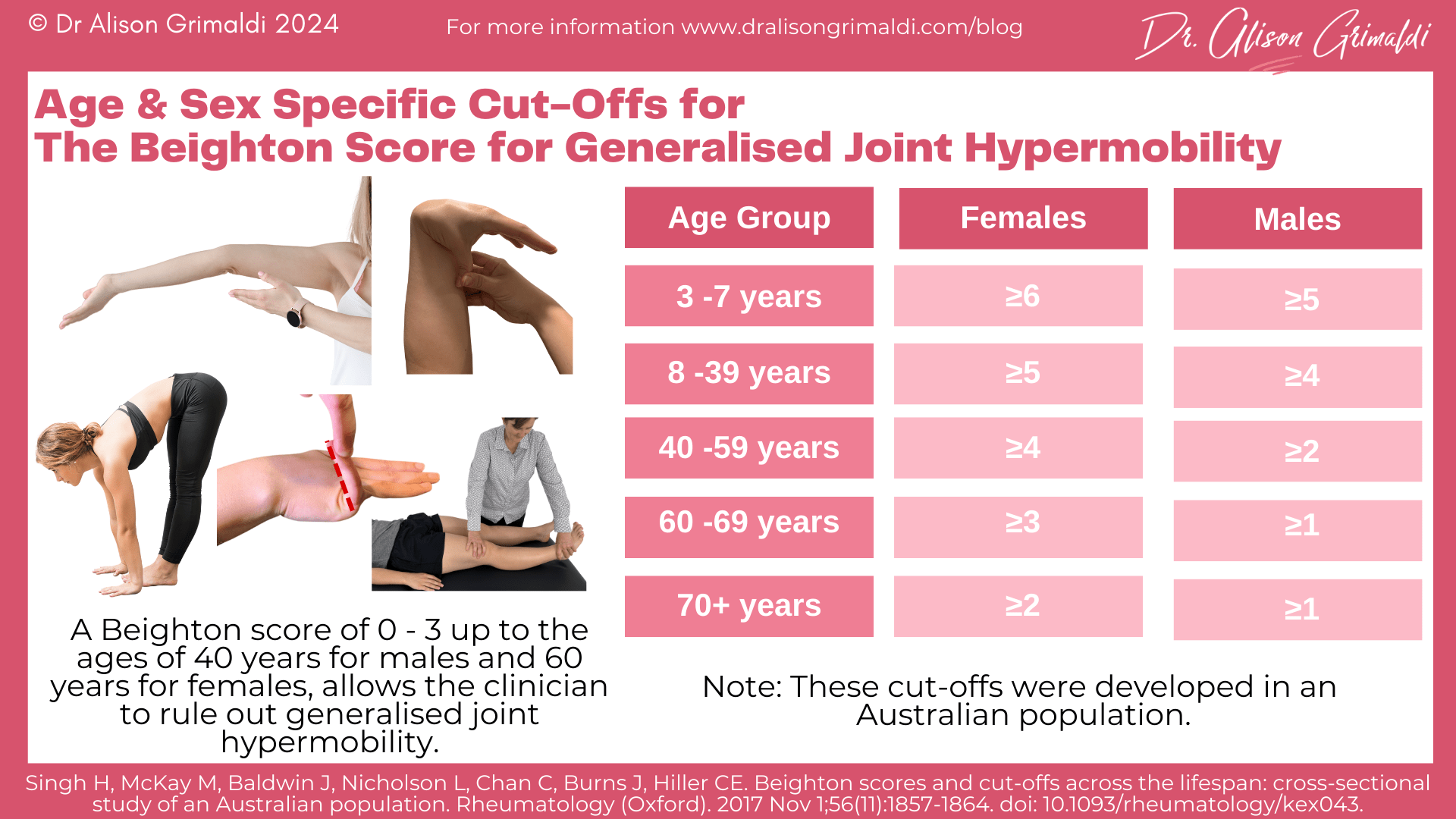 Age-&-Sex-Specific-Cut-Offs-for-The-Beighton-Score-for-Generalised-Joint-Hypermobility