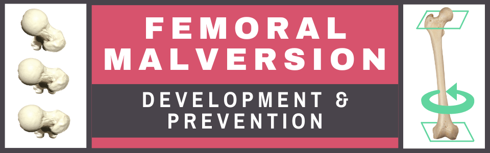 Femoral Malversion - Development & Prevention Femoral Malversion - Development & Prevention
