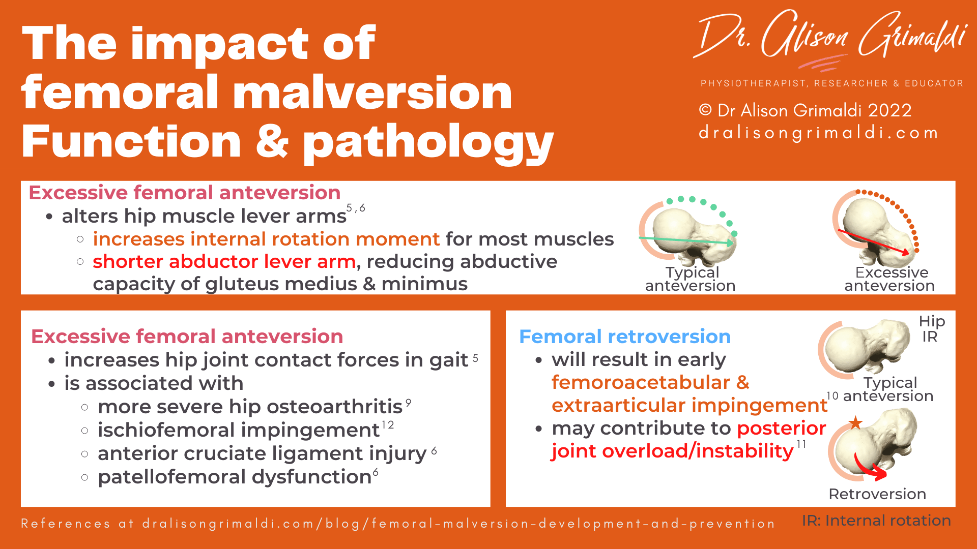Normal femoral version & femoral malversion Normal femoral version & femoral malversion