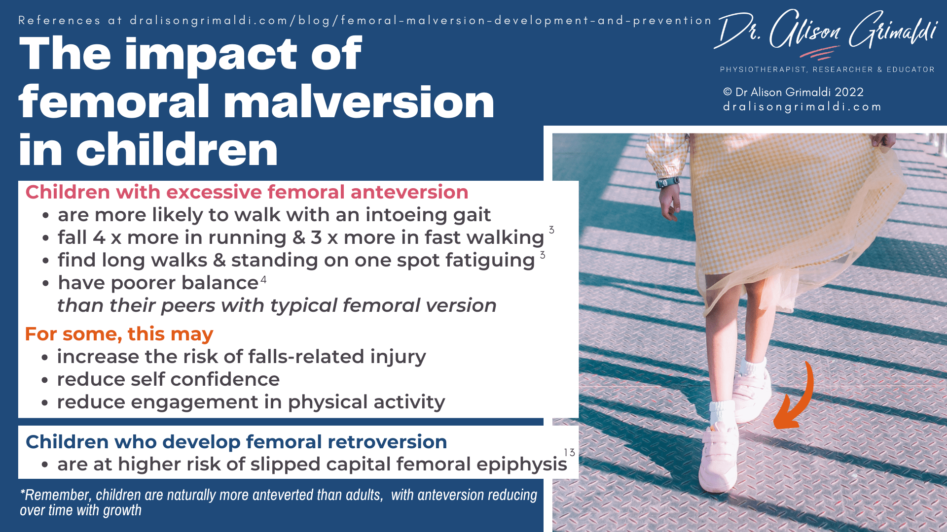 The impact of femoral malversion in children The impact of femoral malversion in children
