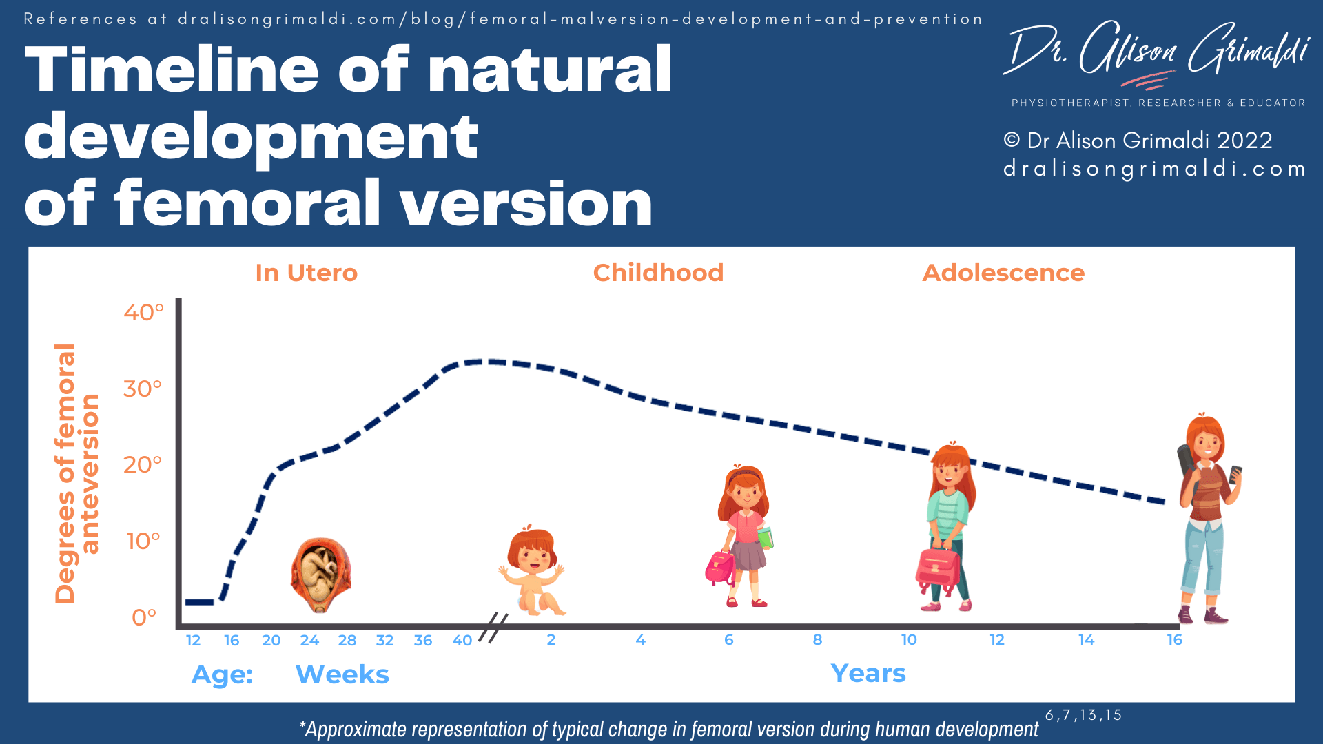 Timeline of natural development of femoral version Timeline of natural development of femoral version