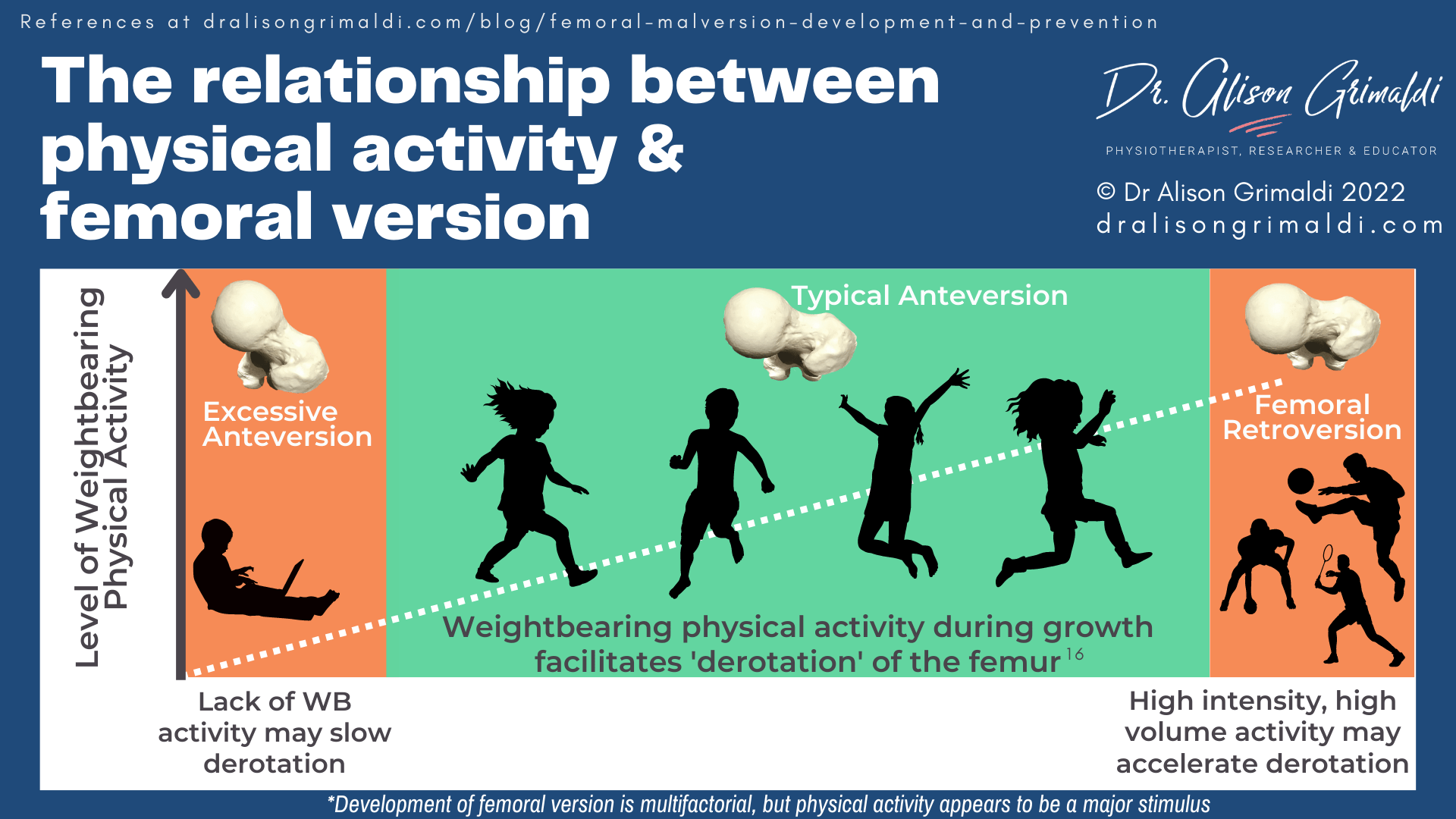 The relationship between physical activity & femoral version The relationship between physical activity & femoral version