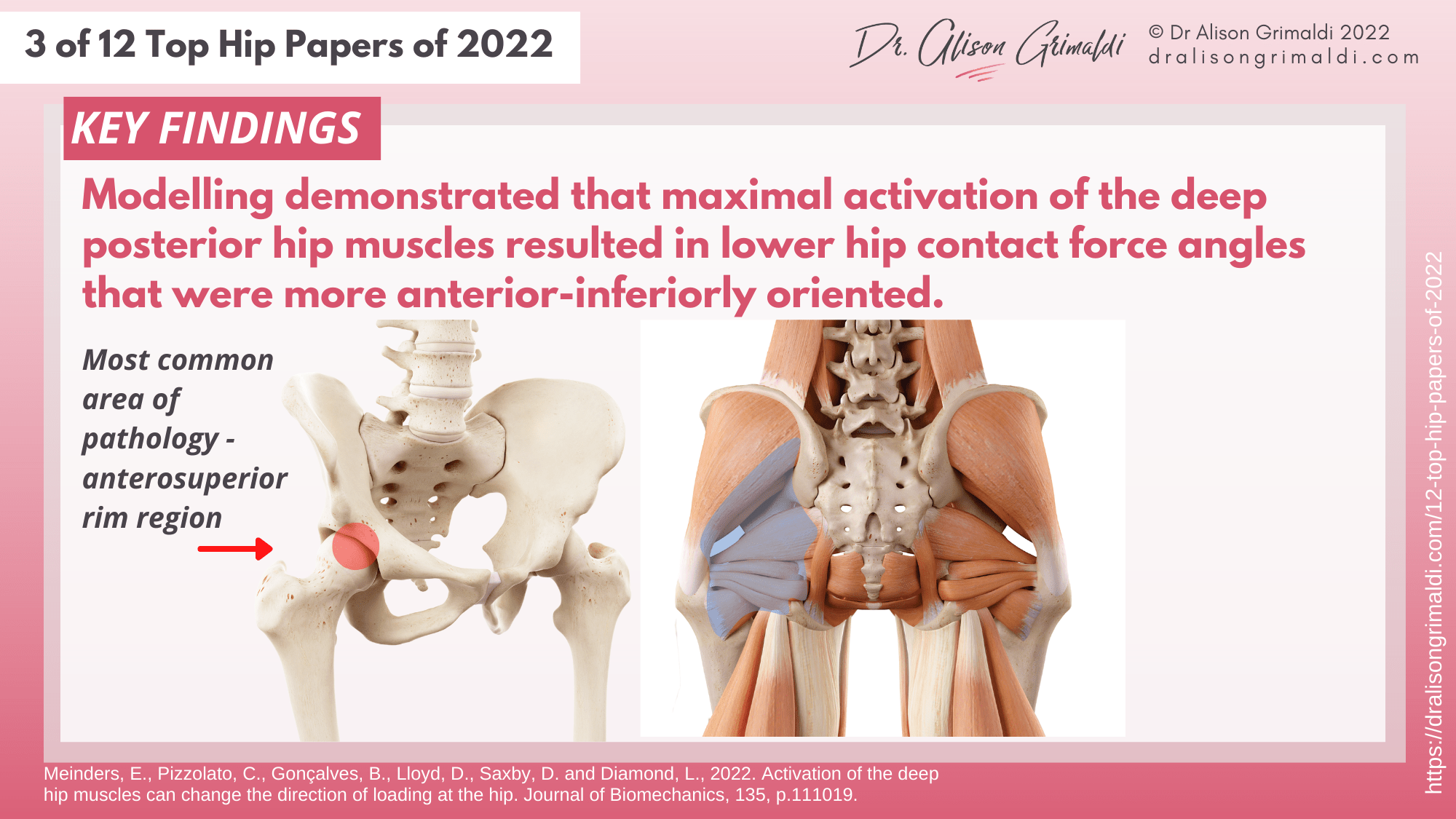 Key Findings - 3 of 12 - deep hip muscles and hip joint loads Key Findings - 3 of 12 - deep hip muscles and hip joint loads