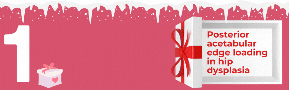 Top Banner Graphic - 1 of 12 - acetabular dysplasia, exercise