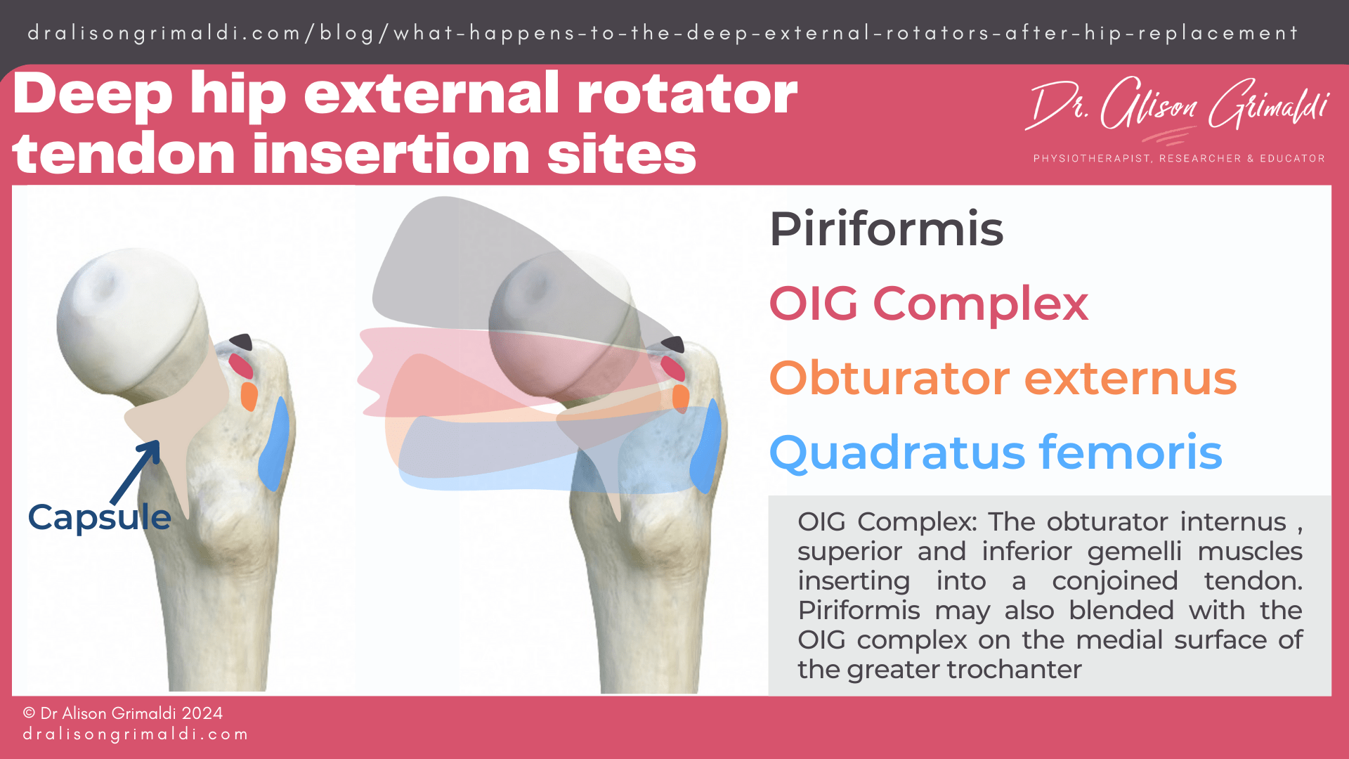 deep-hip-external-rotator-tendon-insertion-sites
