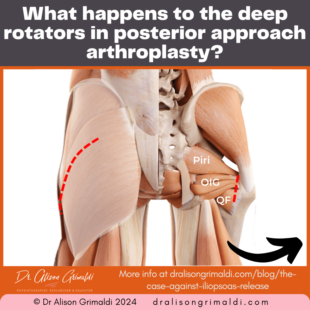 what-happens-to-the-deep-rotators-in-posterior-approach-arthroplasty