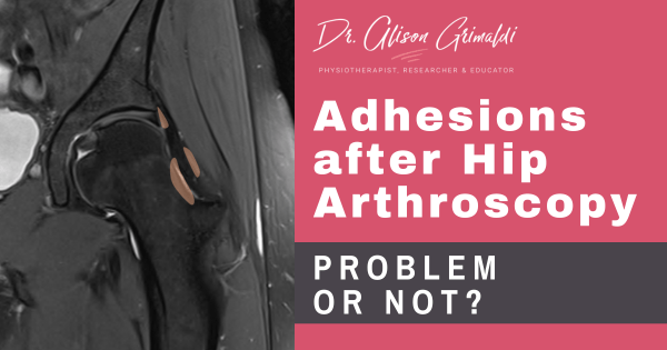 adhesions-after-hip-arthroscopy-prevention-&-treatment adhesions-after-hip-arthroscopy-prevention-&-treatment