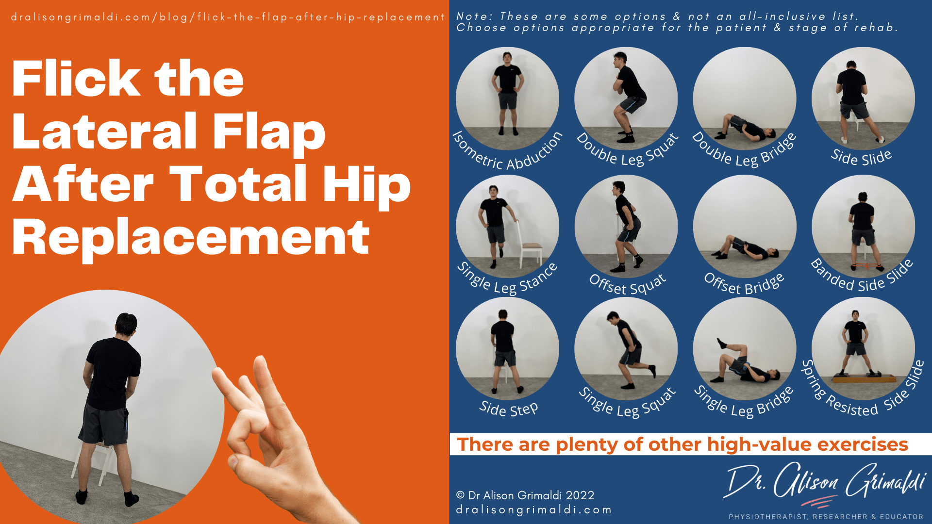Flick the Lateral Flap After Total Hip Replacement Flick the Lateral Flap After Total Hip Replacement
