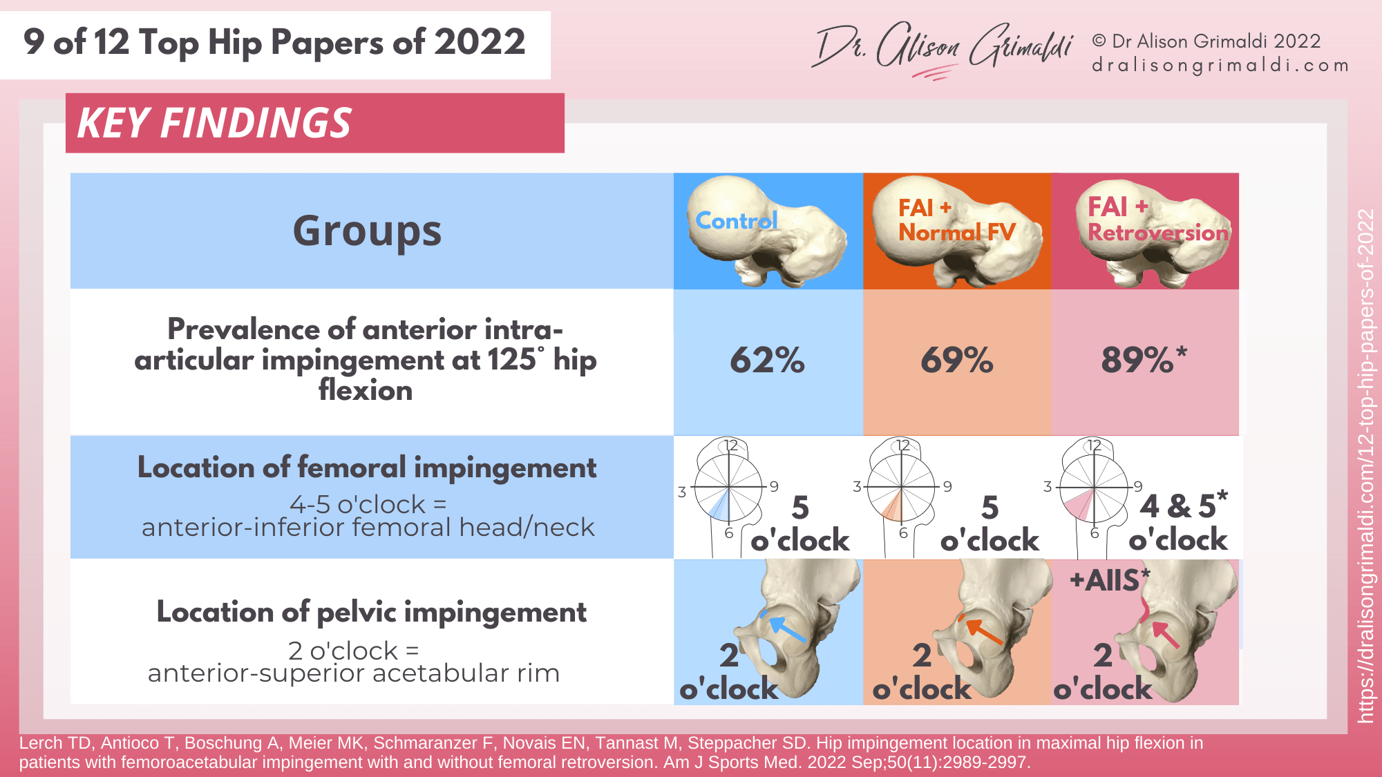 Key Findings - 9 of 12 - FAIS, femoroacetabular impingement, femoroacetabular impingement, femoral malversion Key Findings - 9 of 12 - FAIS, femoroacetabular impingement, femoroacetabular impingement, femoral malversion