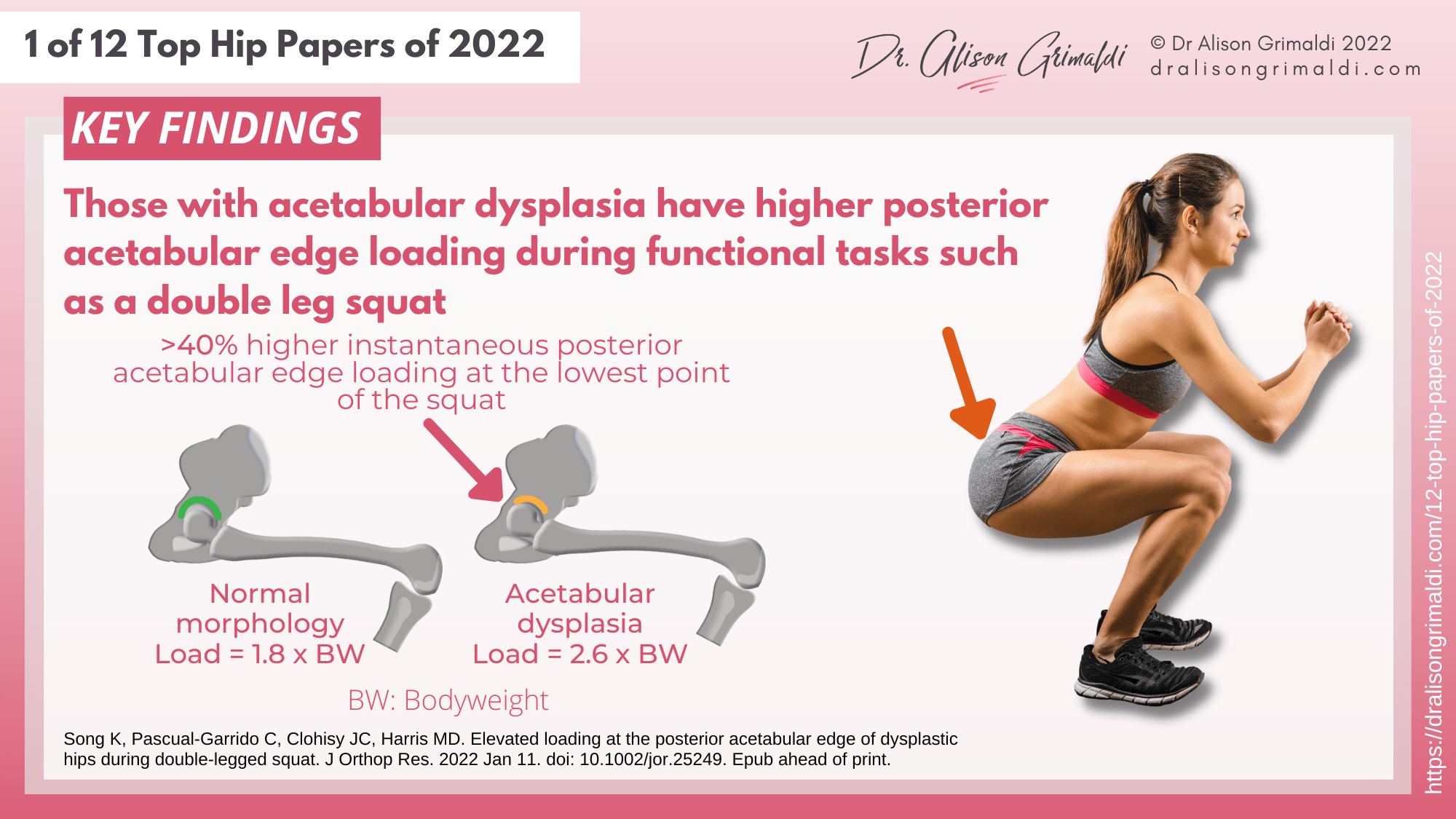 Key Findings - 1 of 12 - acetabular dysplasia, exercise Key Findings - 1 of 12 - acetabular dysplasia, exercise