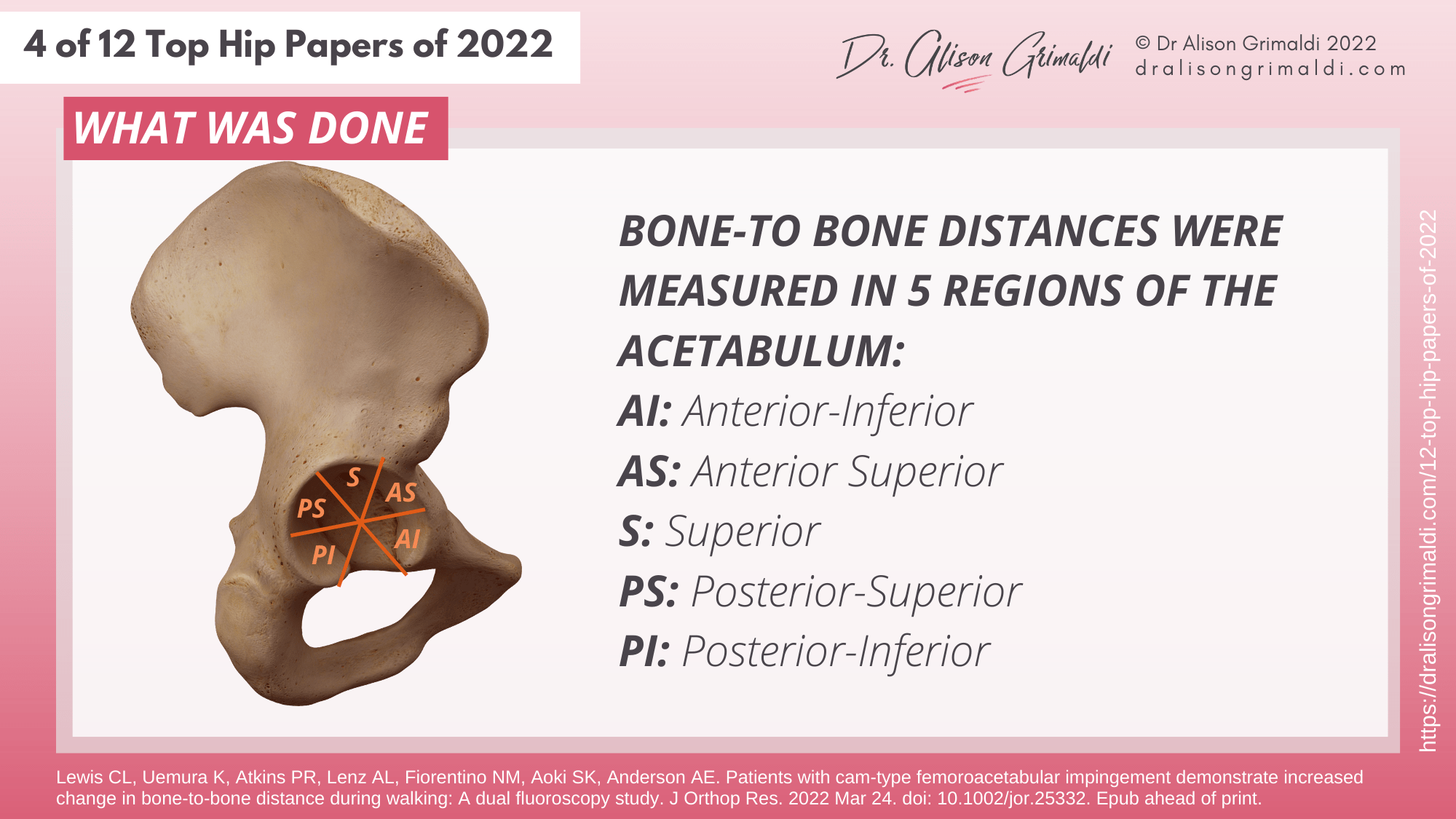 What Was Done - 4 of 12 - femoroacetabular impingement, FAIS, impingement, instability, translation What Was Done - 4 of 12 - femoroacetabular impingement, FAIS, impingement, instability, translation