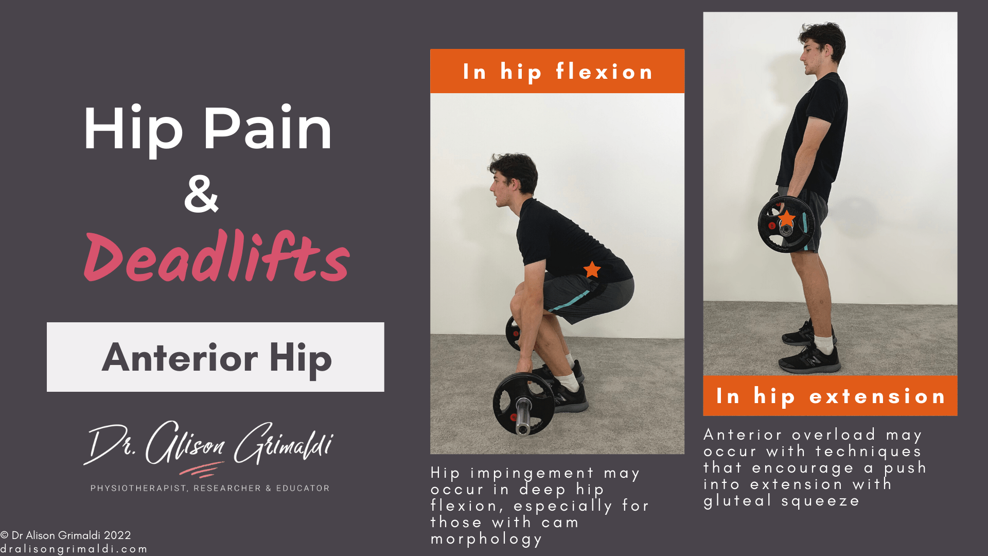 Anterior hip pain and deadlifts_dralisongrimaldi_blog Anterior hip pain and deadlifts_dralisongrimaldi_blog