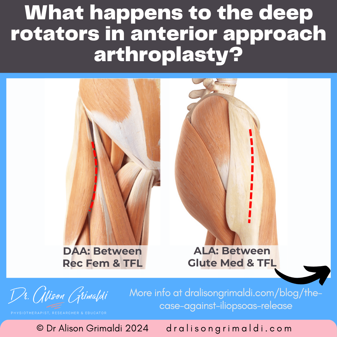 what-happens-to-the-deep-rotators-in-anterior-approach-arthroplasty what-happens-to-the-deep-rotators-in-anterior-approach-arthroplasty