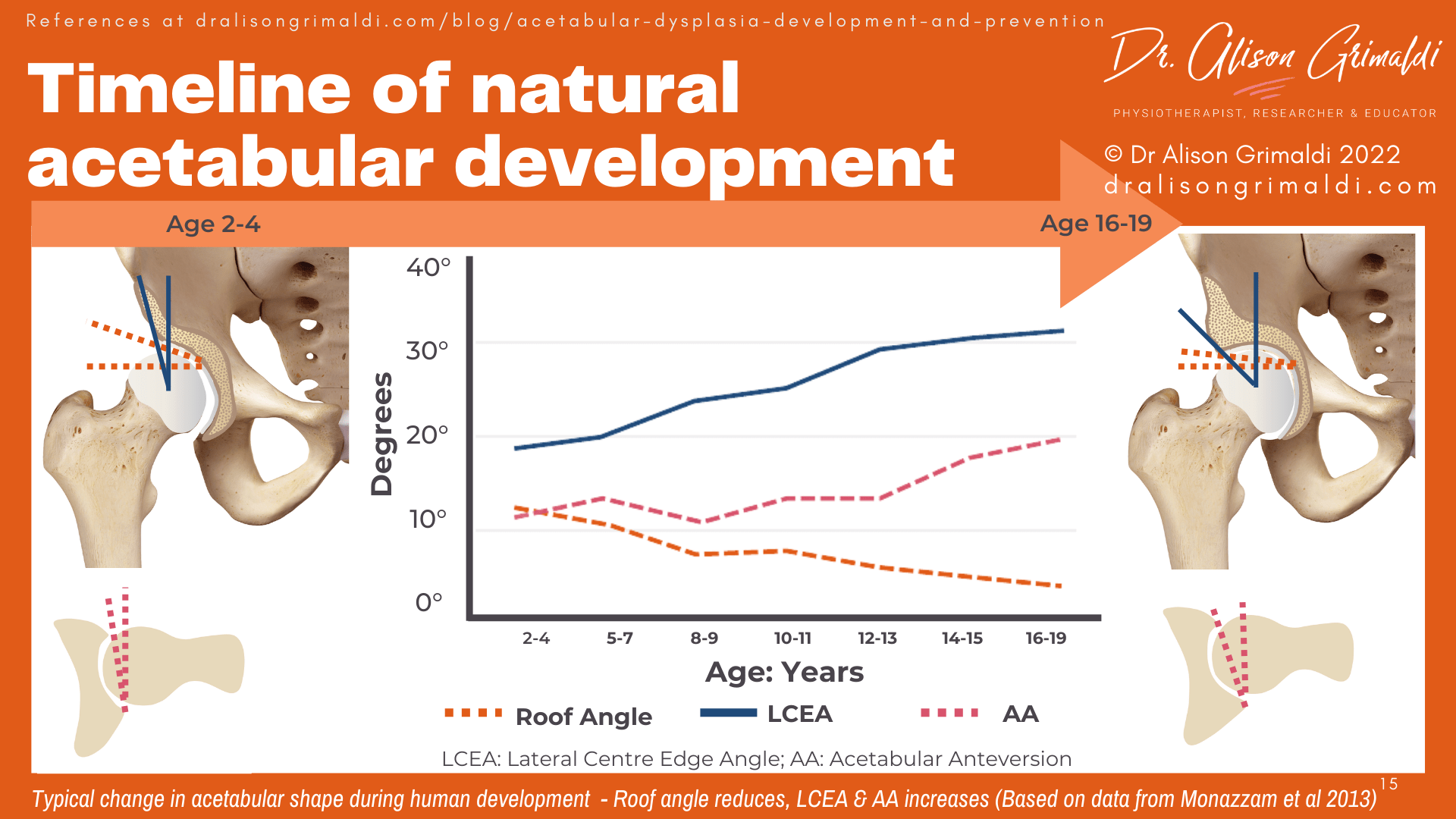 Timeline of natural acetabular development Timeline of natural acetabular development