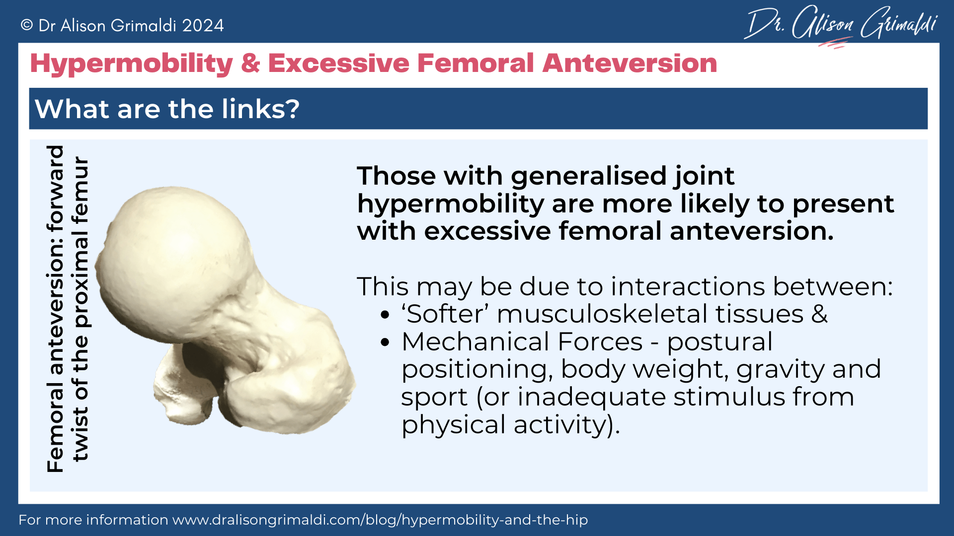 hypermobility-and-excessive-femoral-anteversion hypermobility-and-excessive-femoral-anteversion