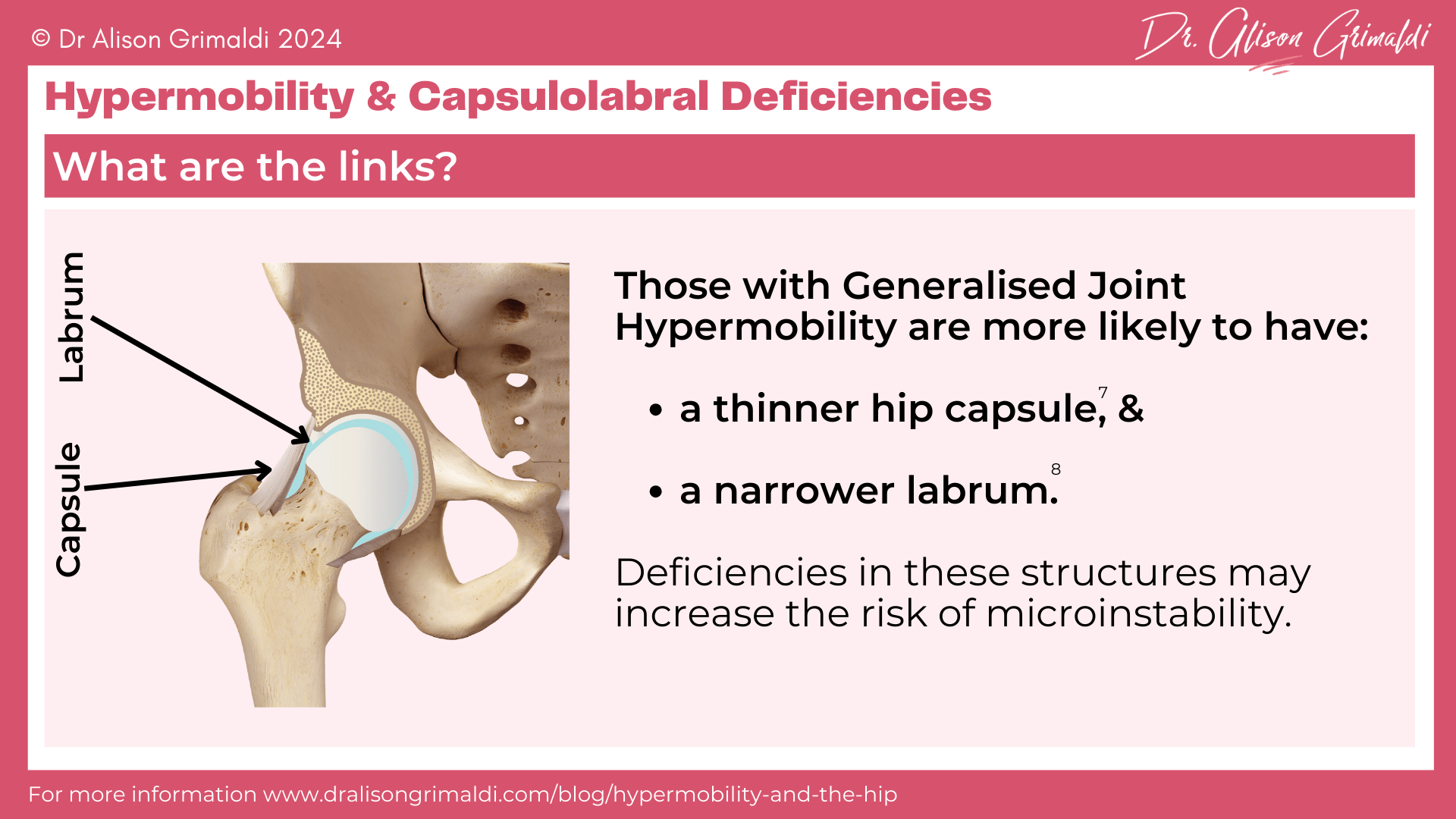 hypermobility-and-capsulolabral-deficiencies hypermobility-and-capsulolabral-deficiencies