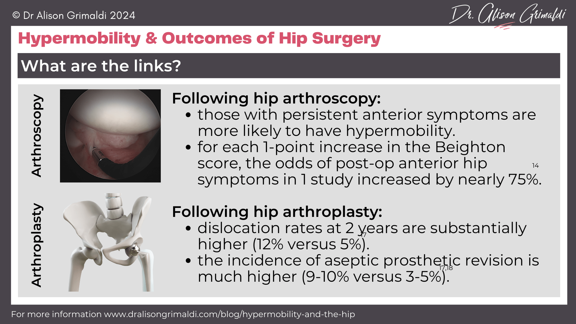 hypermobility-and-outcomes-of-hip-surgery hypermobility-and-outcomes-of-hip-surgery
