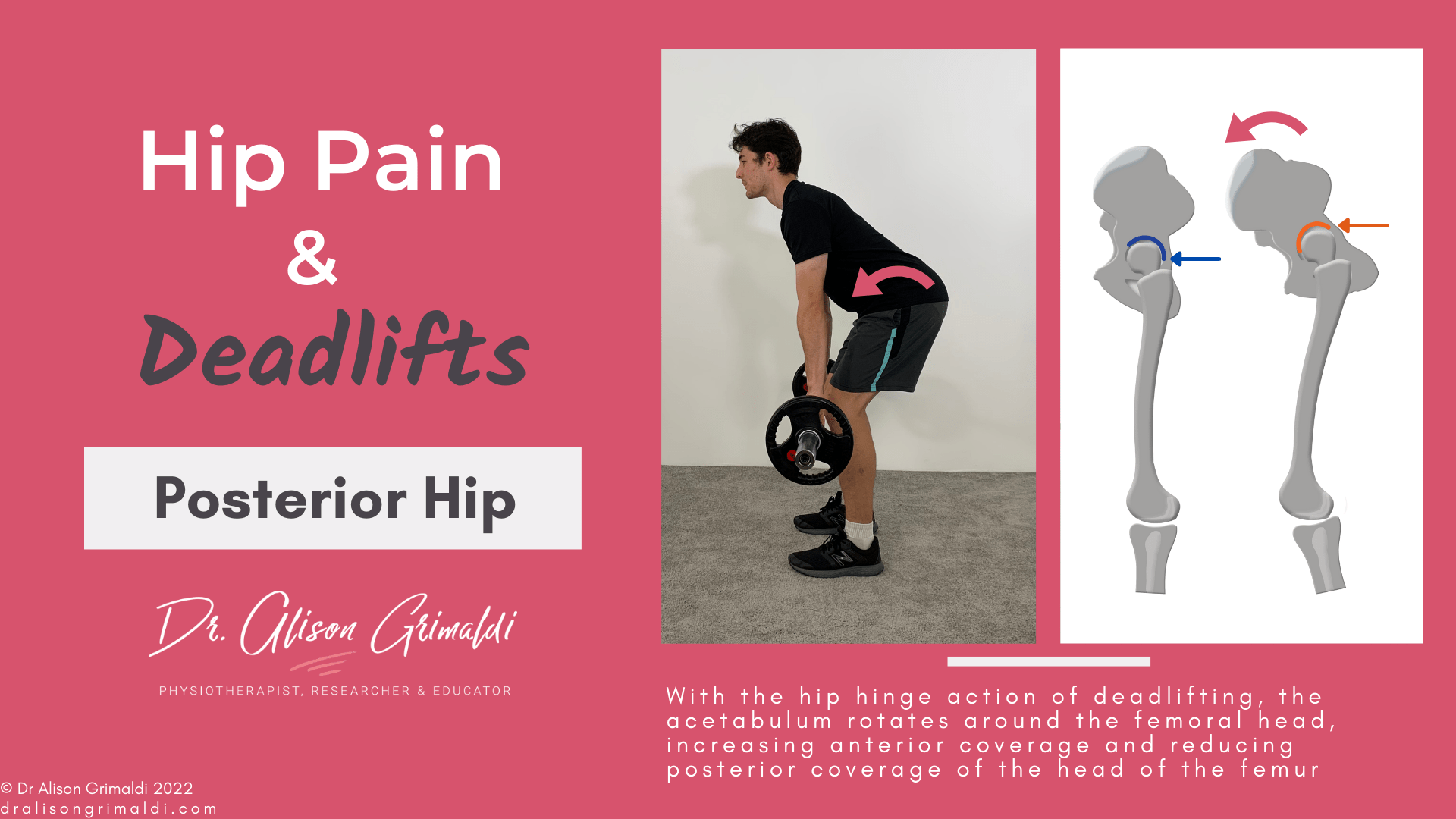 Posterior hip pain and deadlifts_dralisongrimaldi_blog Posterior hip pain and deadlifts_dralisongrimaldi_blog