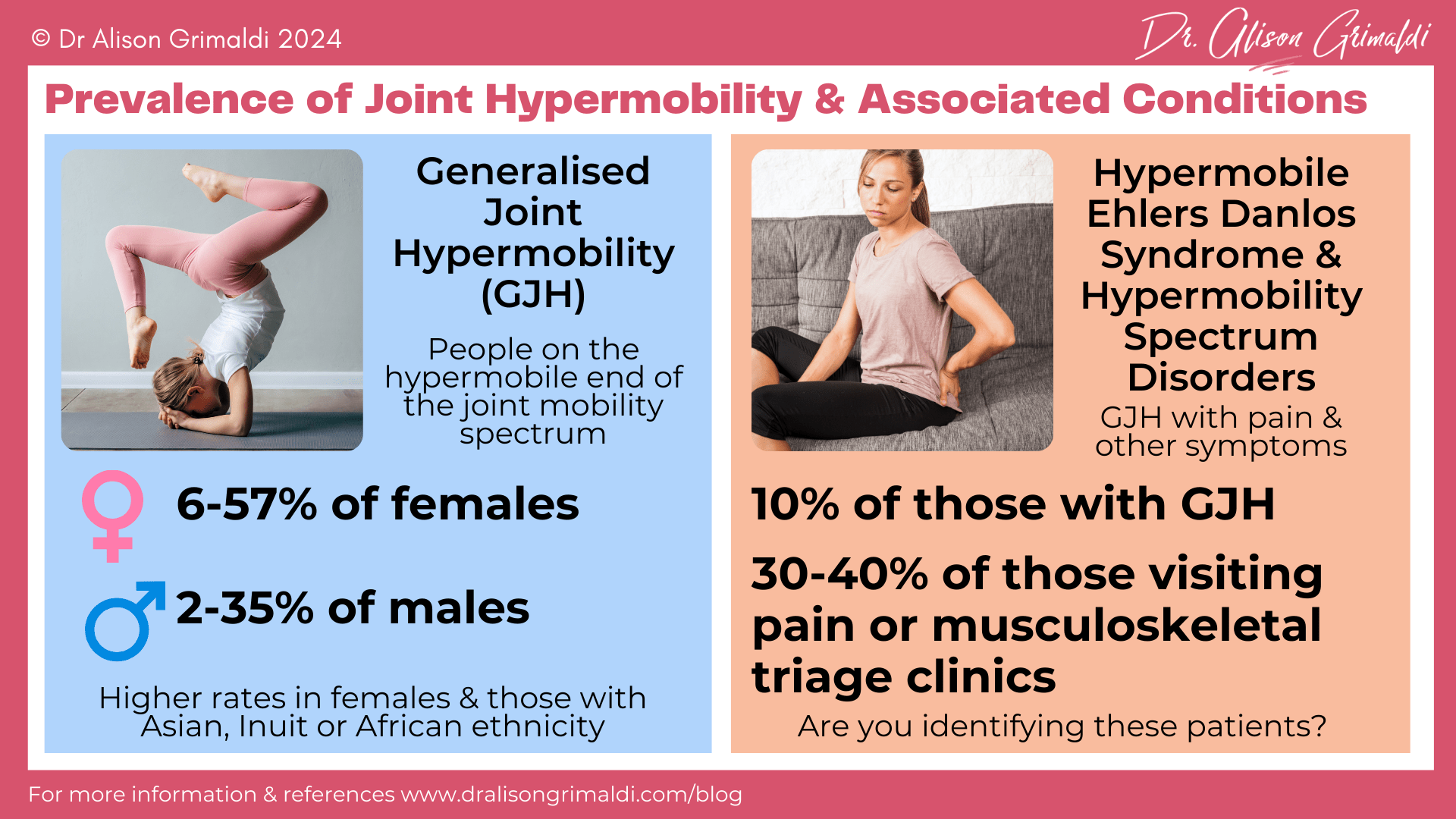 Prevalence-of-Joint-Hypermobility-&-Associated-Conditions Prevalence-of-Joint-Hypermobility-&-Associated-Conditions