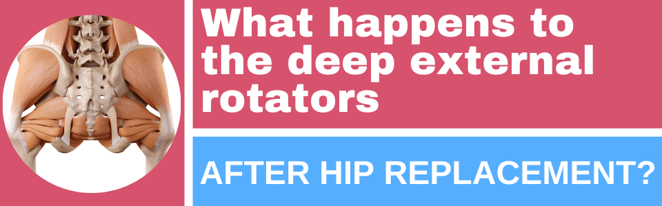 what-happens-to-the-deep-external-rotators-after-hip-replacement what-happens-to-the-deep-external-rotators-after-hip-replacement