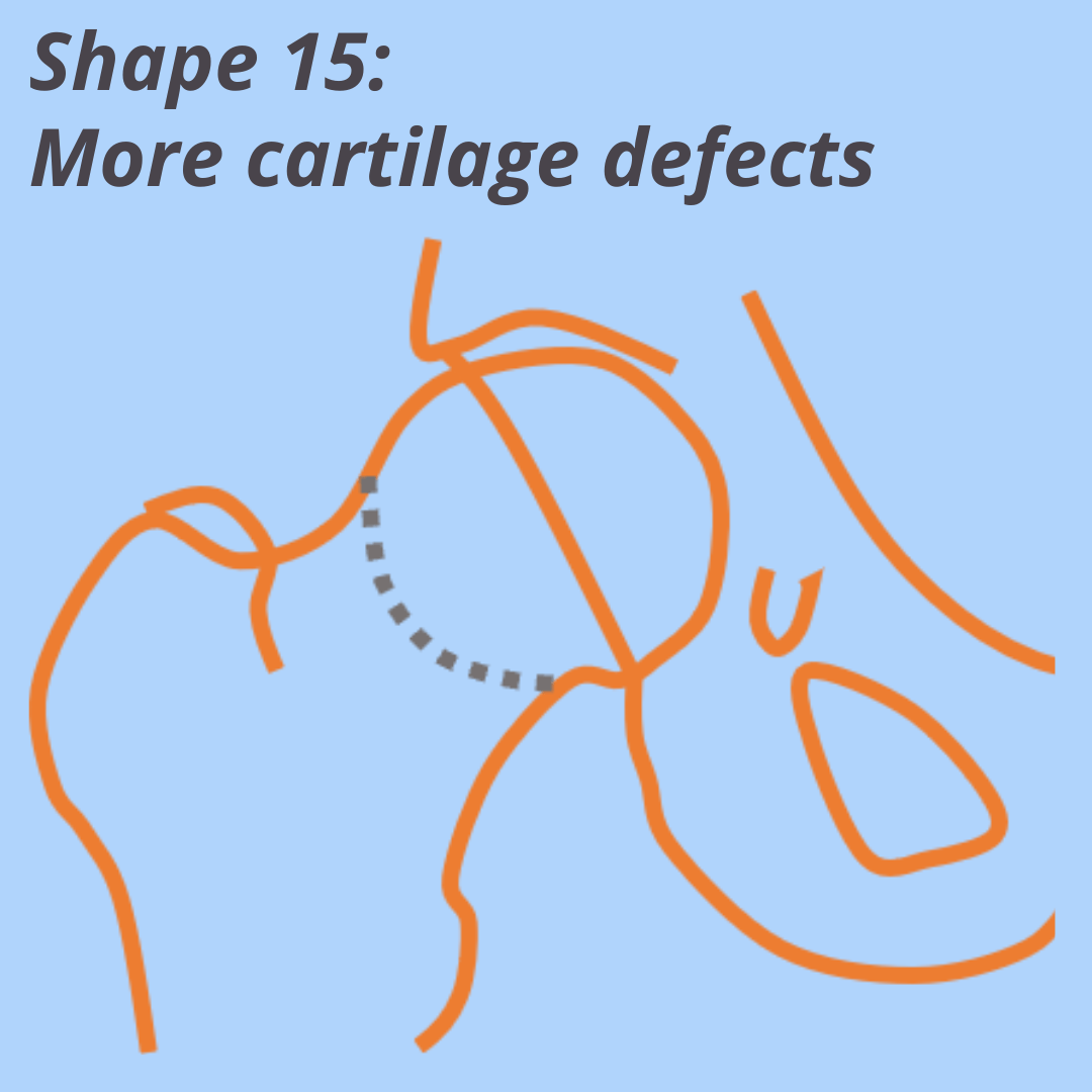 Shape 15: More cartilage defects Shape 15: More cartilage defects