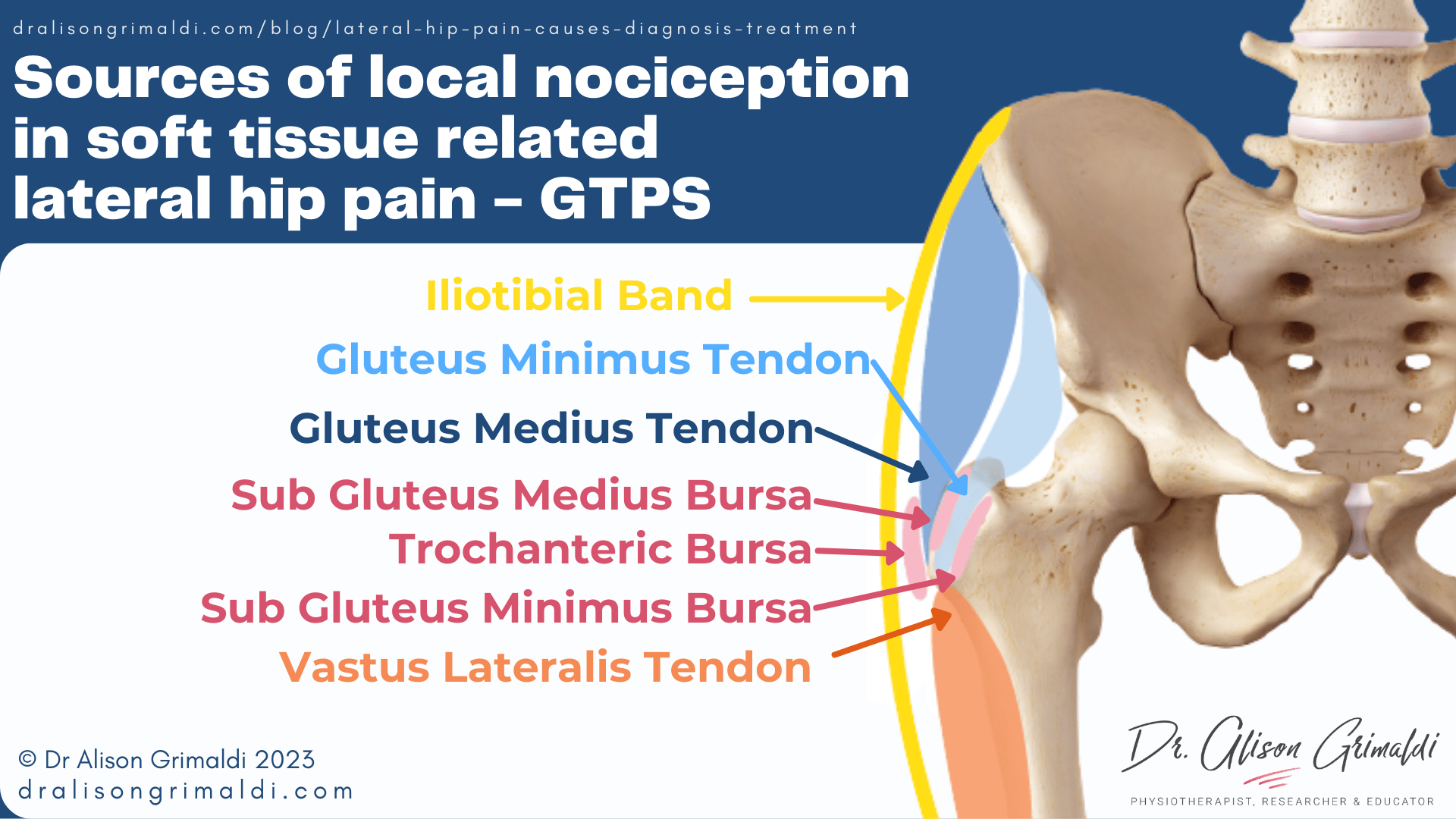 Sources-of-local-nociception-in-soft-tissue-related-lateral-hip-pain-GTPS Sources-of-local-nociception-in-soft-tissue-related-lateral-hip-pain-GTPS