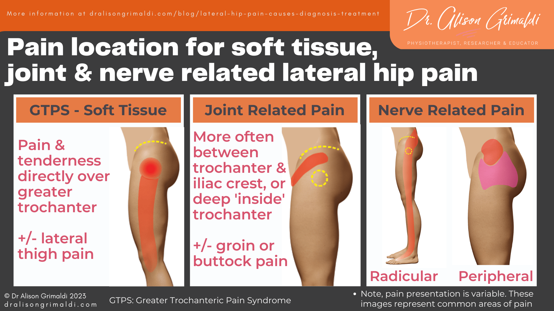 Pain-location-for-soft-tissue-joint-&-nerve-related-lateral-hip-pain Pain-location-for-soft-tissue-joint-&-nerve-related-lateral-hip-pain