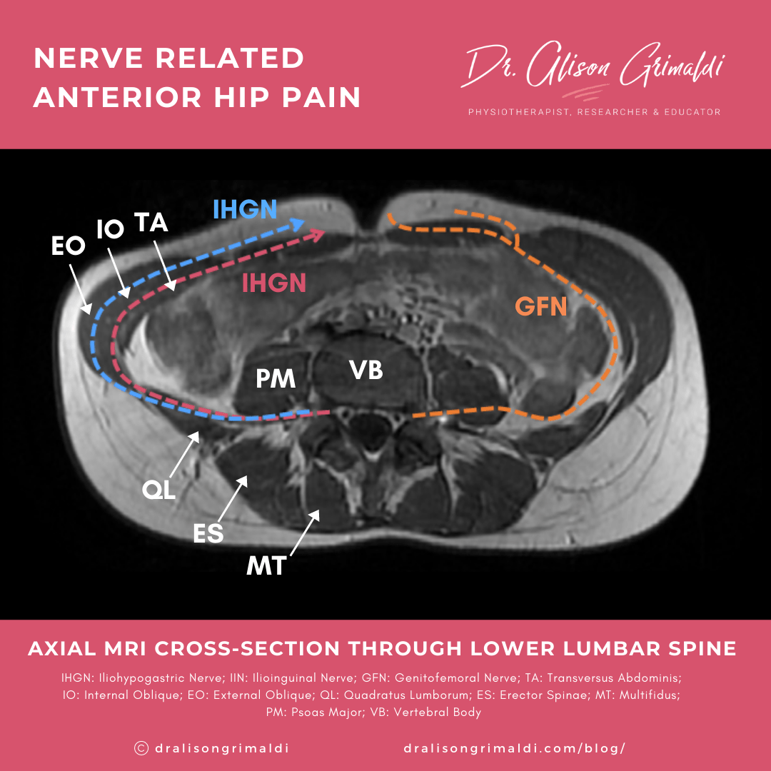 Axial cross section_ pathway of nerves serving the anterior hip_blog infographic Axial cross section_ pathway of nerves serving the anterior hip_blog infographic