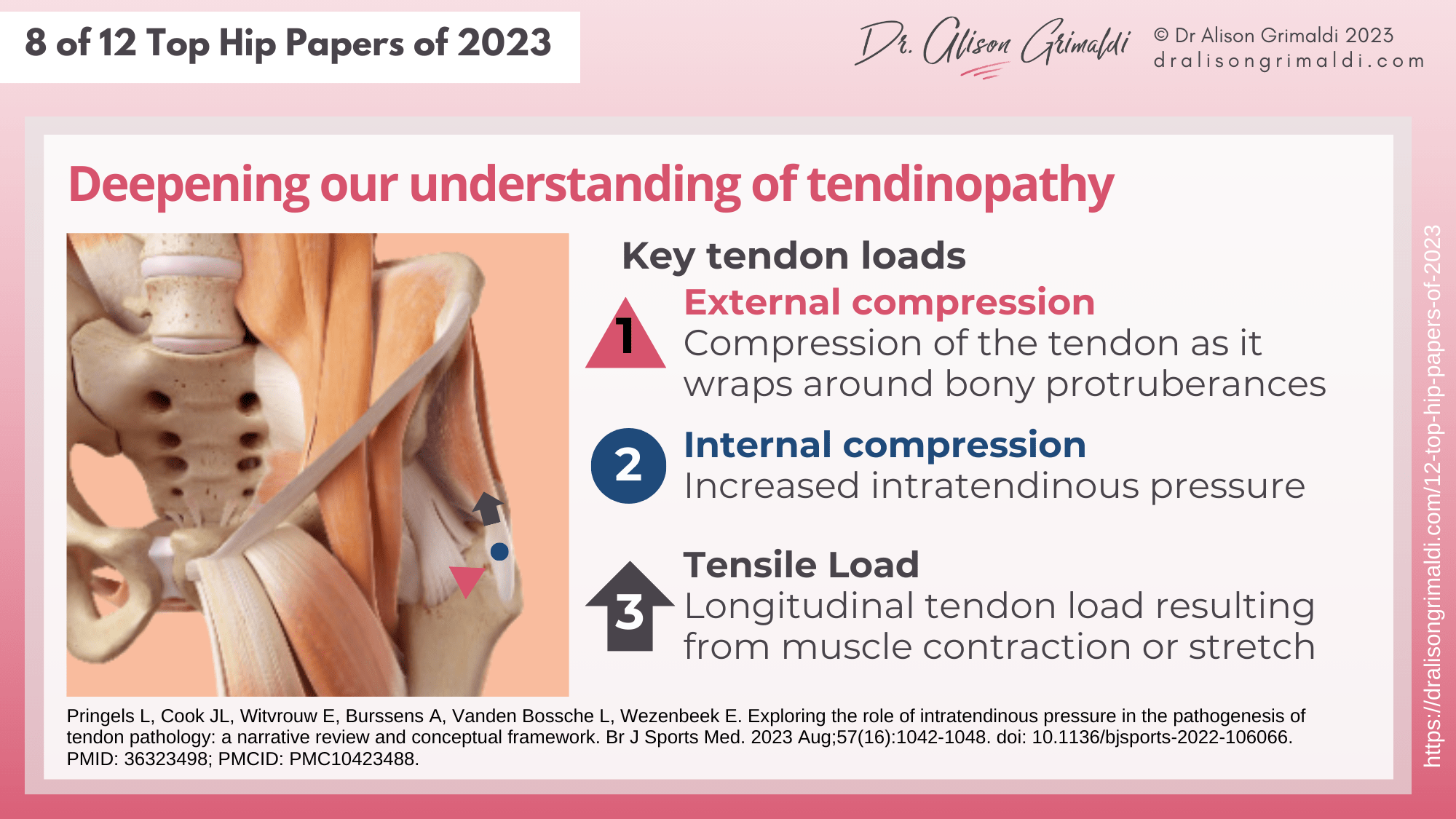 Deepening-our-understanding-of-tendinopathy Deepening-our-understanding-of-tendinopathy
