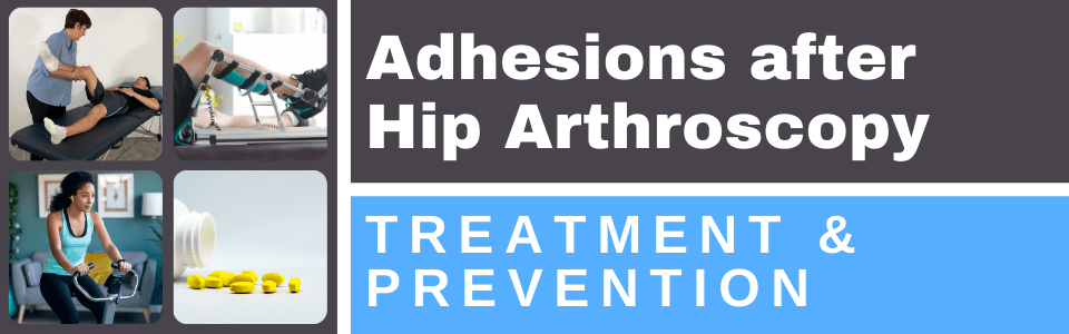 adhesions-after-hip-arthroscopy-treatment-and-prevention adhesions-after-hip-arthroscopy-treatment-and-prevention